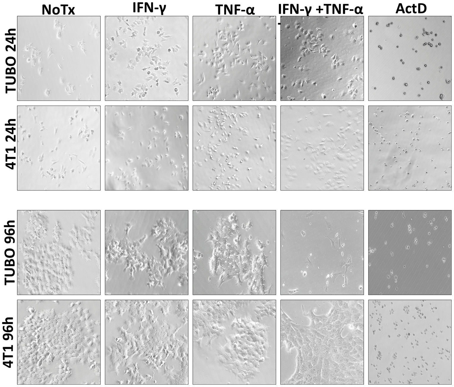 Photo microscopic study of Th1 cytokine-treated murine breast cancer cells