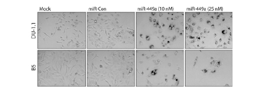 Figure 4 - Senescence.jpg
