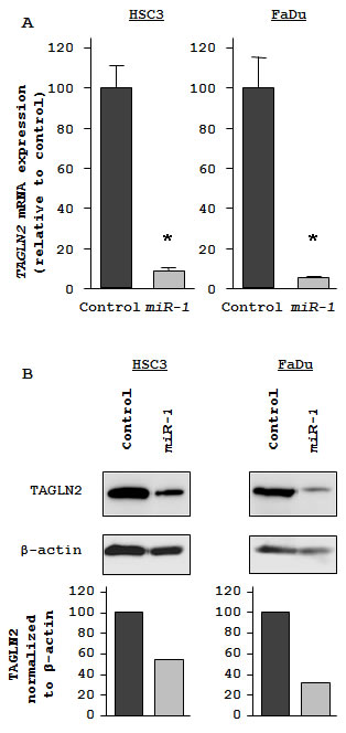 Figures_miR-1_TAGLN2_HNSCC_20110114.pdf