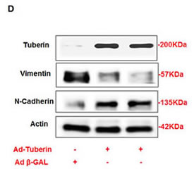 fig1d