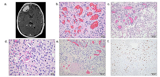 FIG3