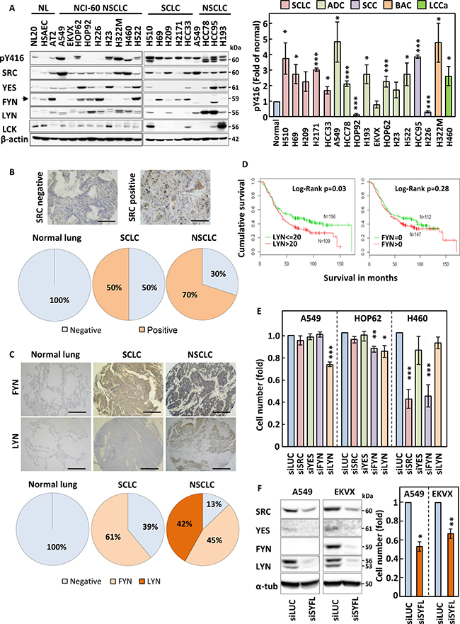 Figure 1: SRC family members are overexpressed in lung cancer.