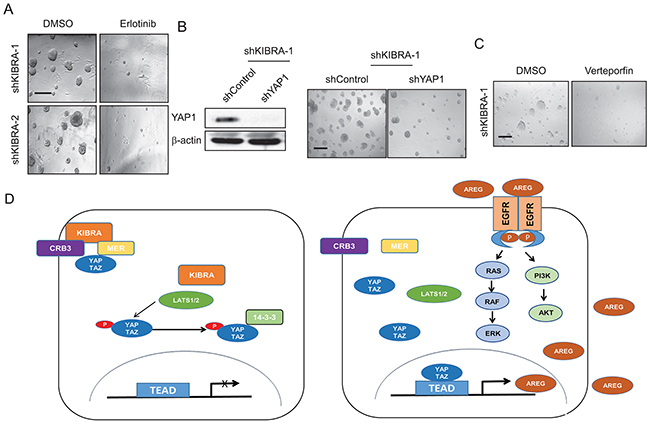 Figure 5: Low KIBRA expression predicts poor breast cancer patient outcome.