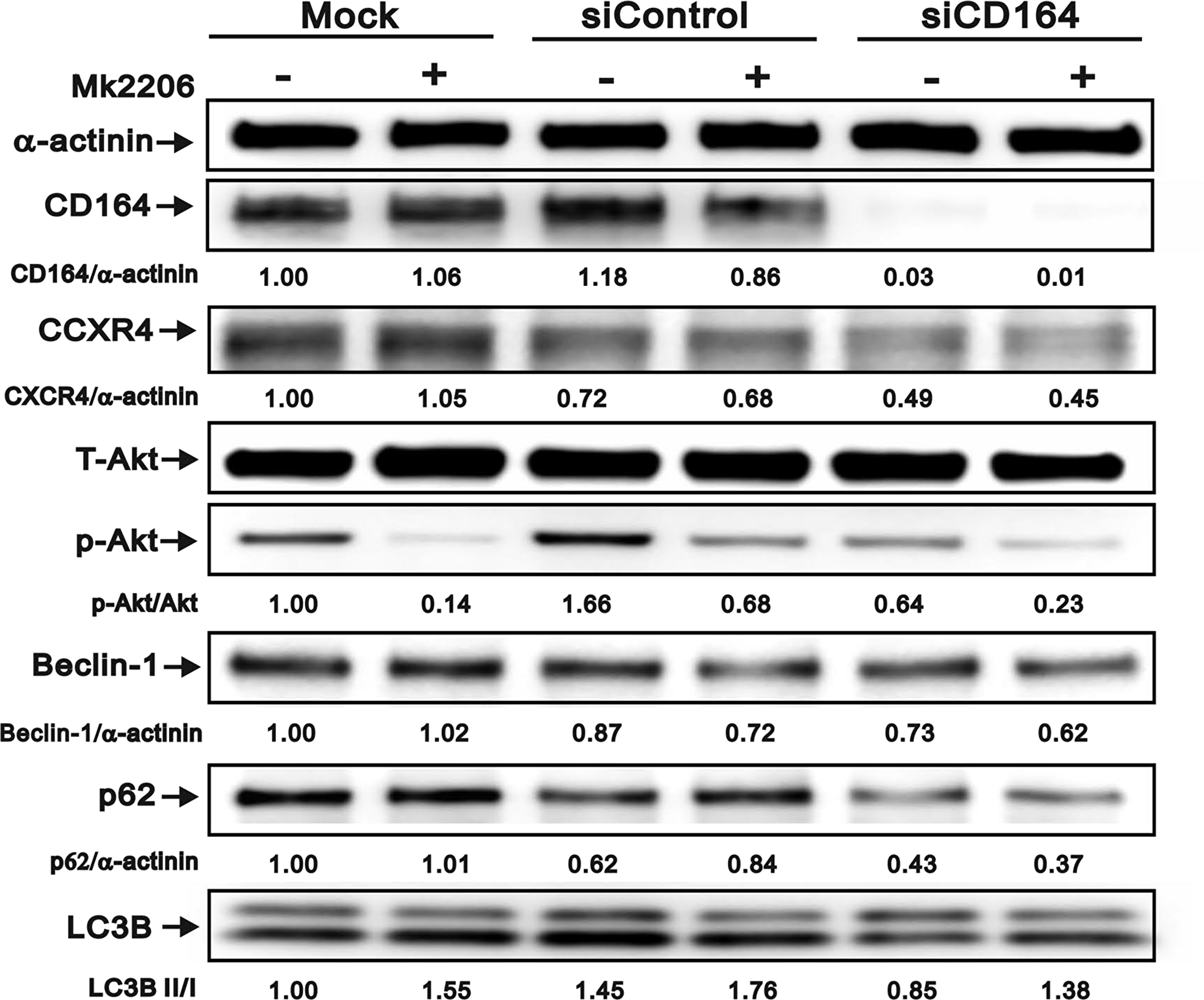 Effect of Akt inhibition on autophagy marker expression in GBM cells.