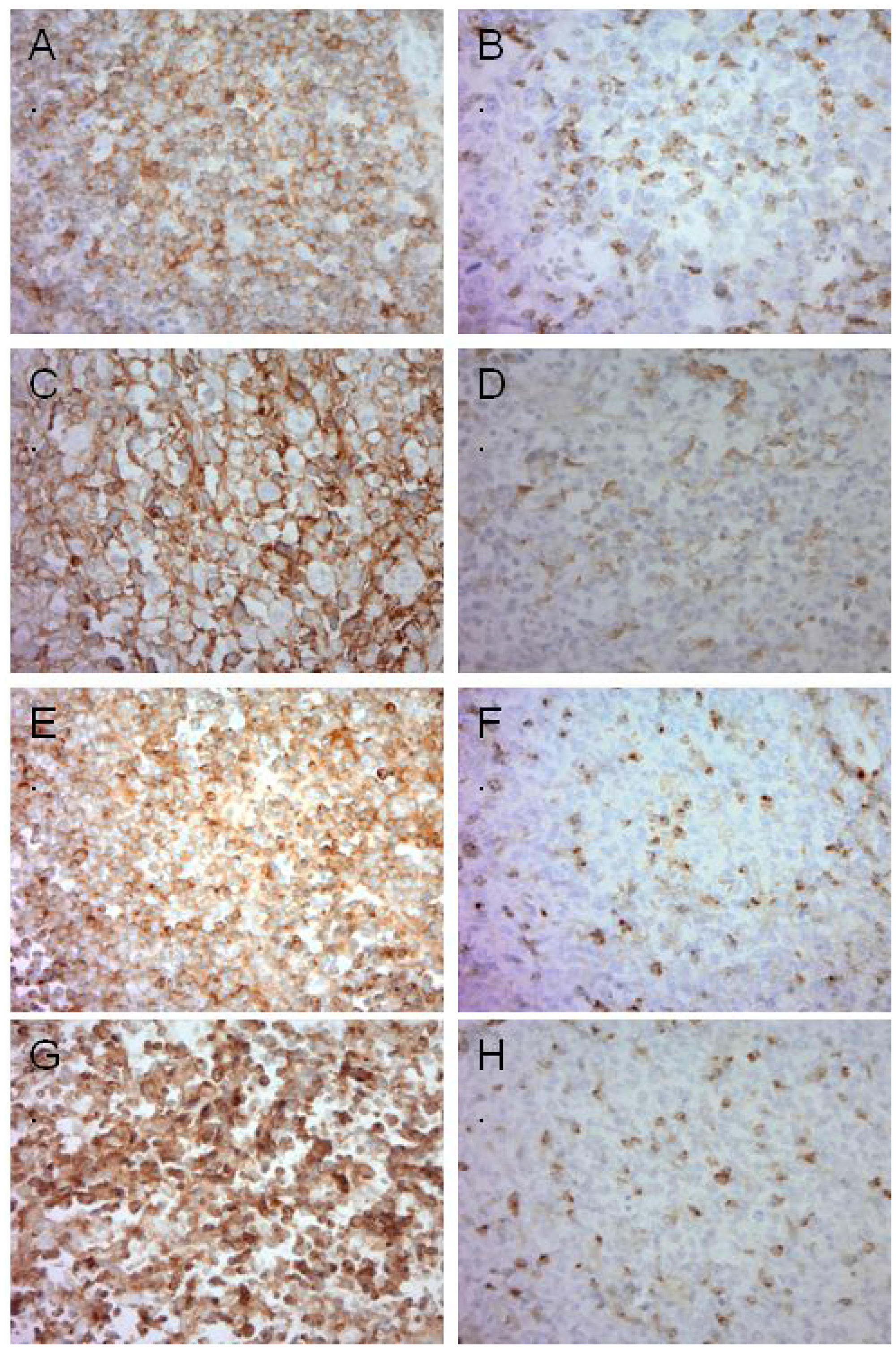 Representative images of immunohistochemistry in DLBCL.