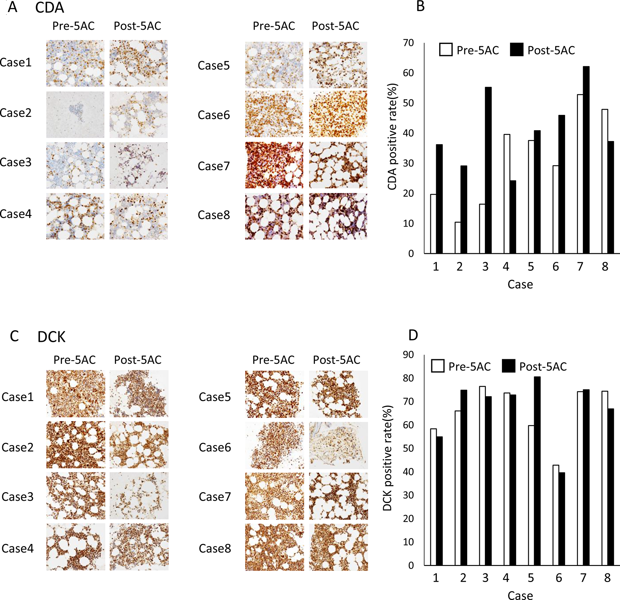 The IHC analysis of clinical samples from patients with MDS.