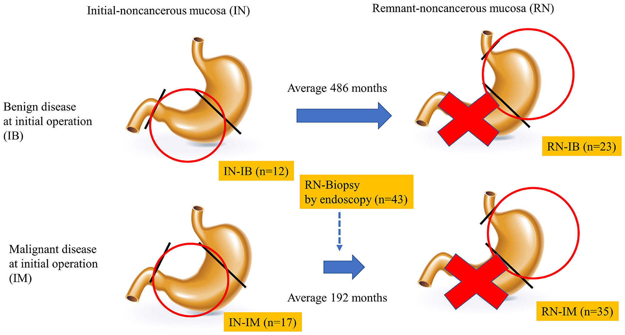 Scheme of the period of sampling non-cancerous mucosa.