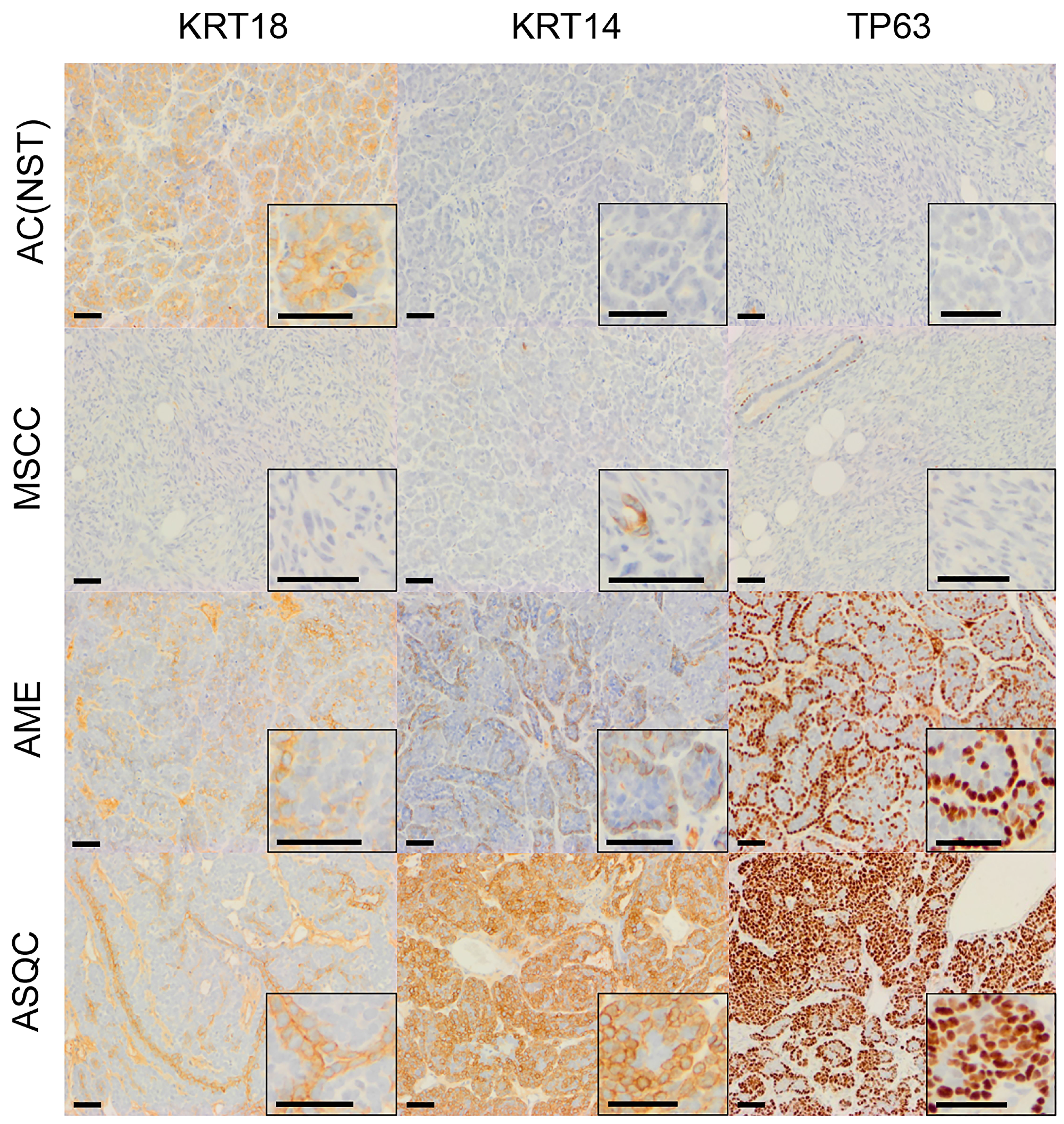 Immunohistochemical staining of olaparib-naïve tumours of different phenotypes in the Blg-CreBrca2/p53-mutant mammary tumour model.
