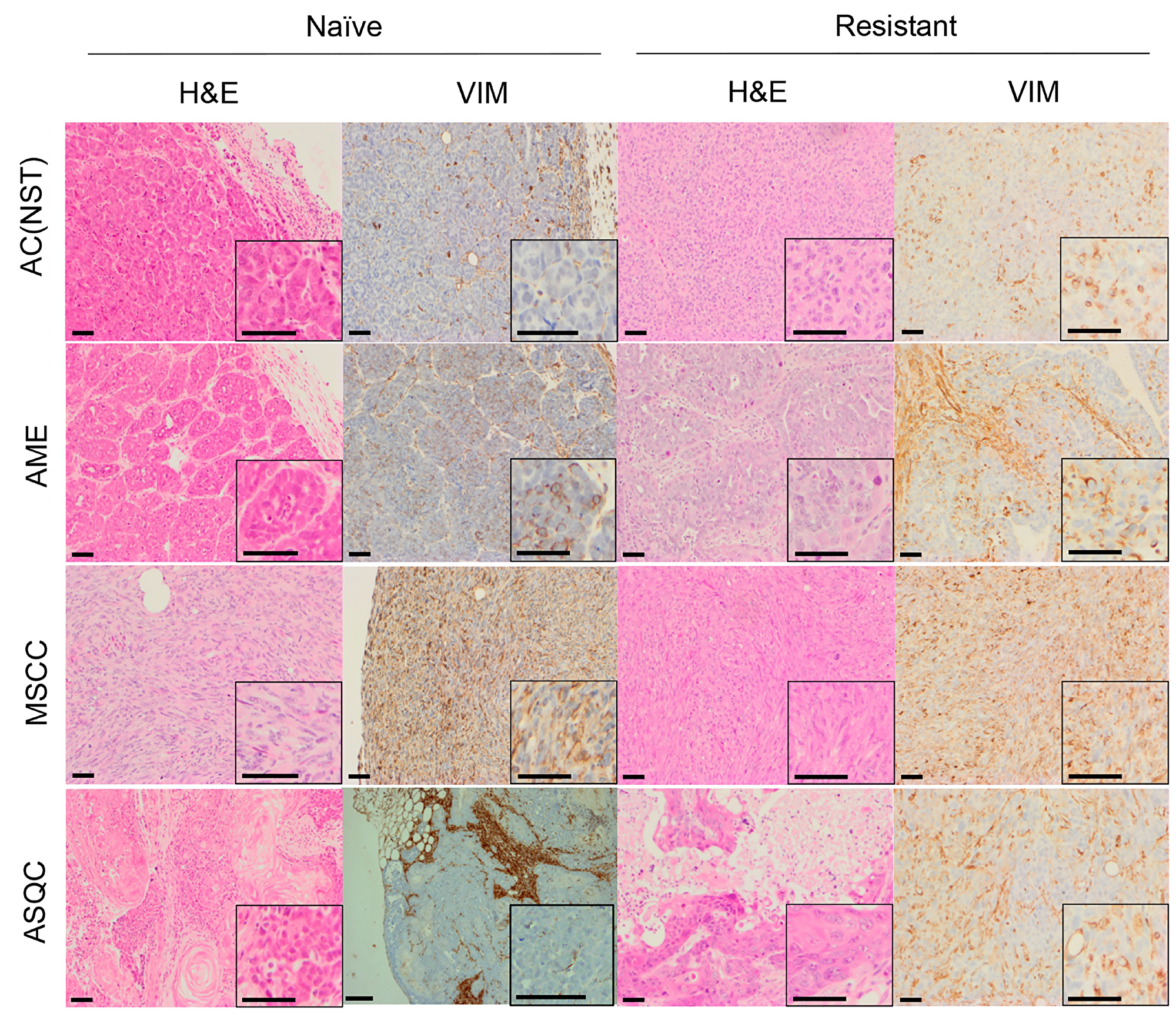 H&E and vimentin staining of tumour phenotypes observed in olaparib-naïve and olaparib-resistant tumours in the Brca2/p53-mutant mammary tumour model.