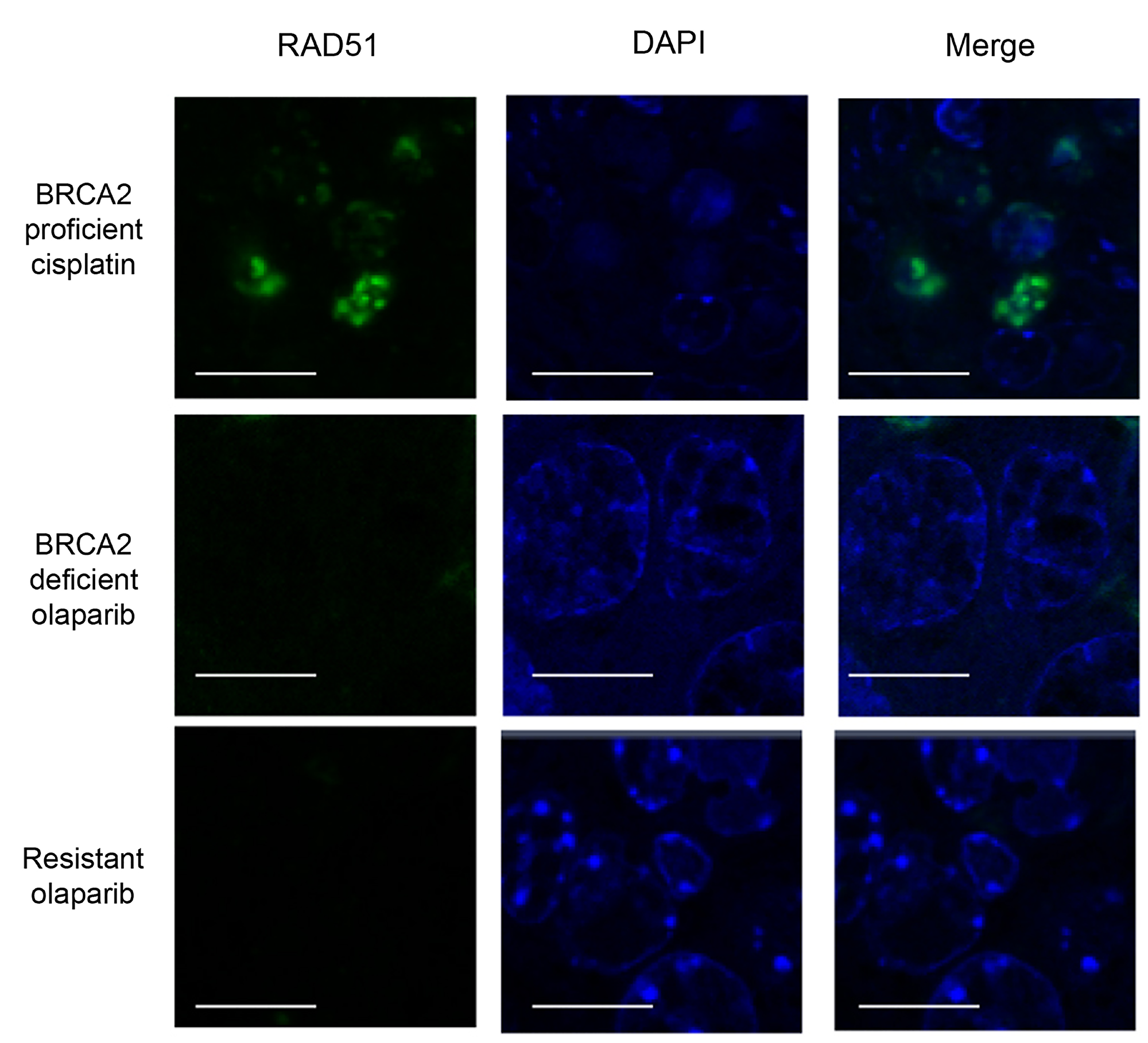 Olaparib-resistant tumours do not have Rad51 foci.
