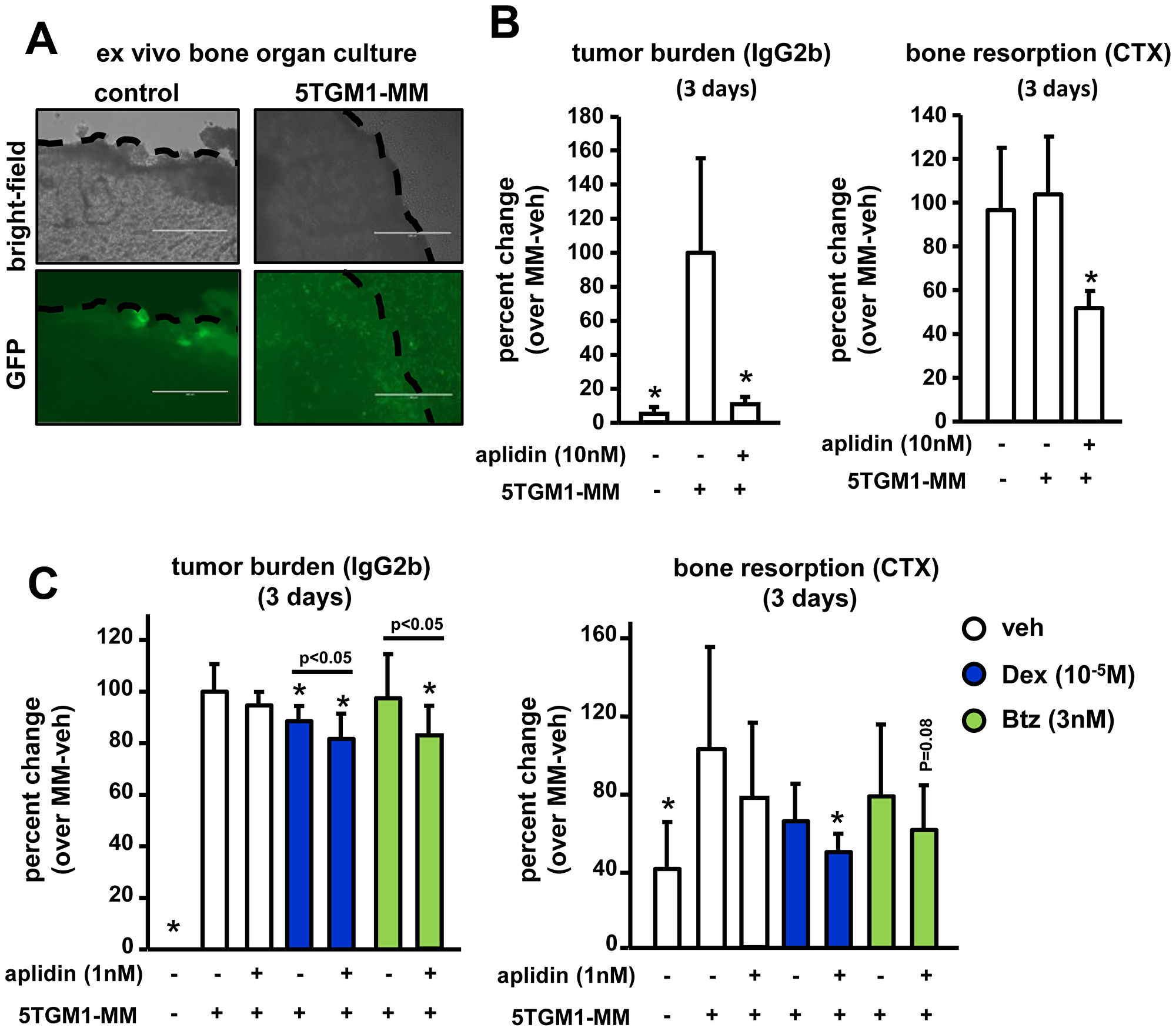 Aplidin decreases tumor growth and inhibits bone resorption in an ex vivo bone organ model of multiple myeloma.