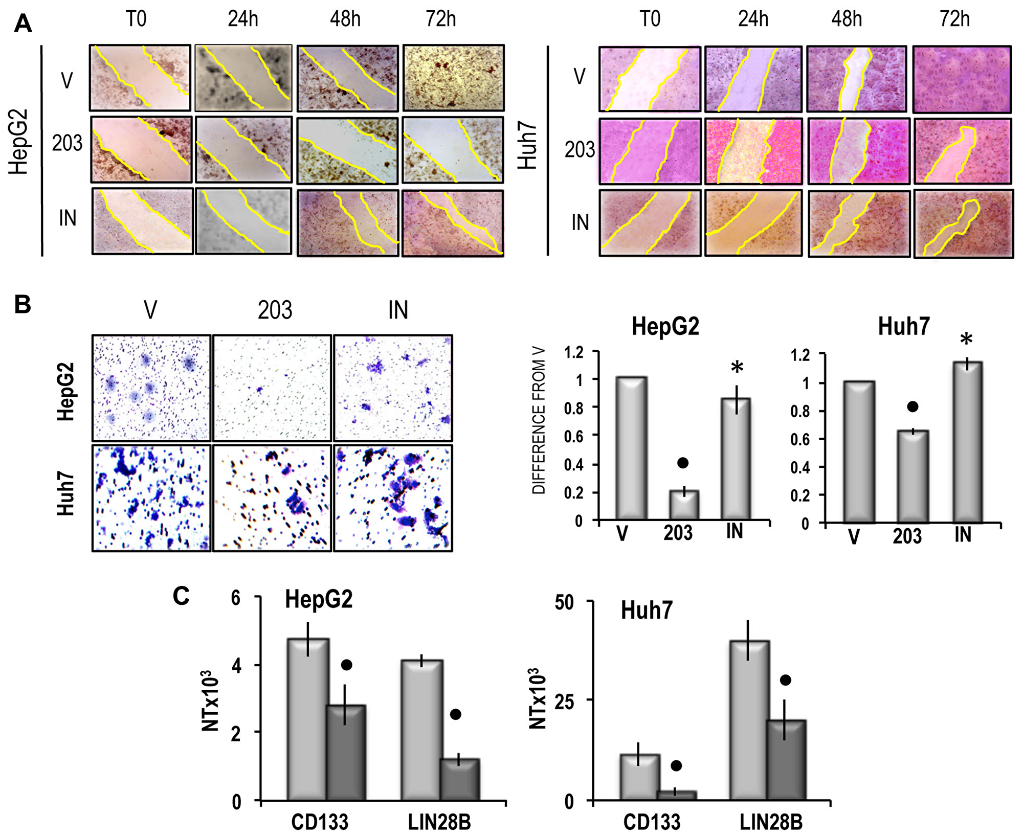 (A) Representative images of migration ability of cells transfected with miR-203 in RNAiMAX vehicle (V) or miR-203 inhibitor (IN) evaluated by wound healing assay. The restriction of the wounded area was evaluated at the times indicated after wounding (zero-time). Three independent analyses of cell migration in vitro did not show significant variations of the wounded area restriction at the different times. (B) Left panels: representative images of invasivity of cells transfected with miR-203 in RNAiMAX vehicle, empty vehicle (V) or miR-203 inhibitor (IN); rigth panels: mean differences from V ± SD (n = 3). Mann-Whitney test: Point, different from V for P P C) CD133 and LIN28B expression. The results are expressed as N-fold differences in target gene expression relative to the RNR-18 expression, named N Target (NT). NT = 2–ΔCT, ΔCT of each sample was calculated by subtracting the Ct of the target gene from the Ct of the RNR-18 gene. Data are means ± standard deviation (SD) of 5 experiments. Mann-Whitney test: Point, different from V for P 