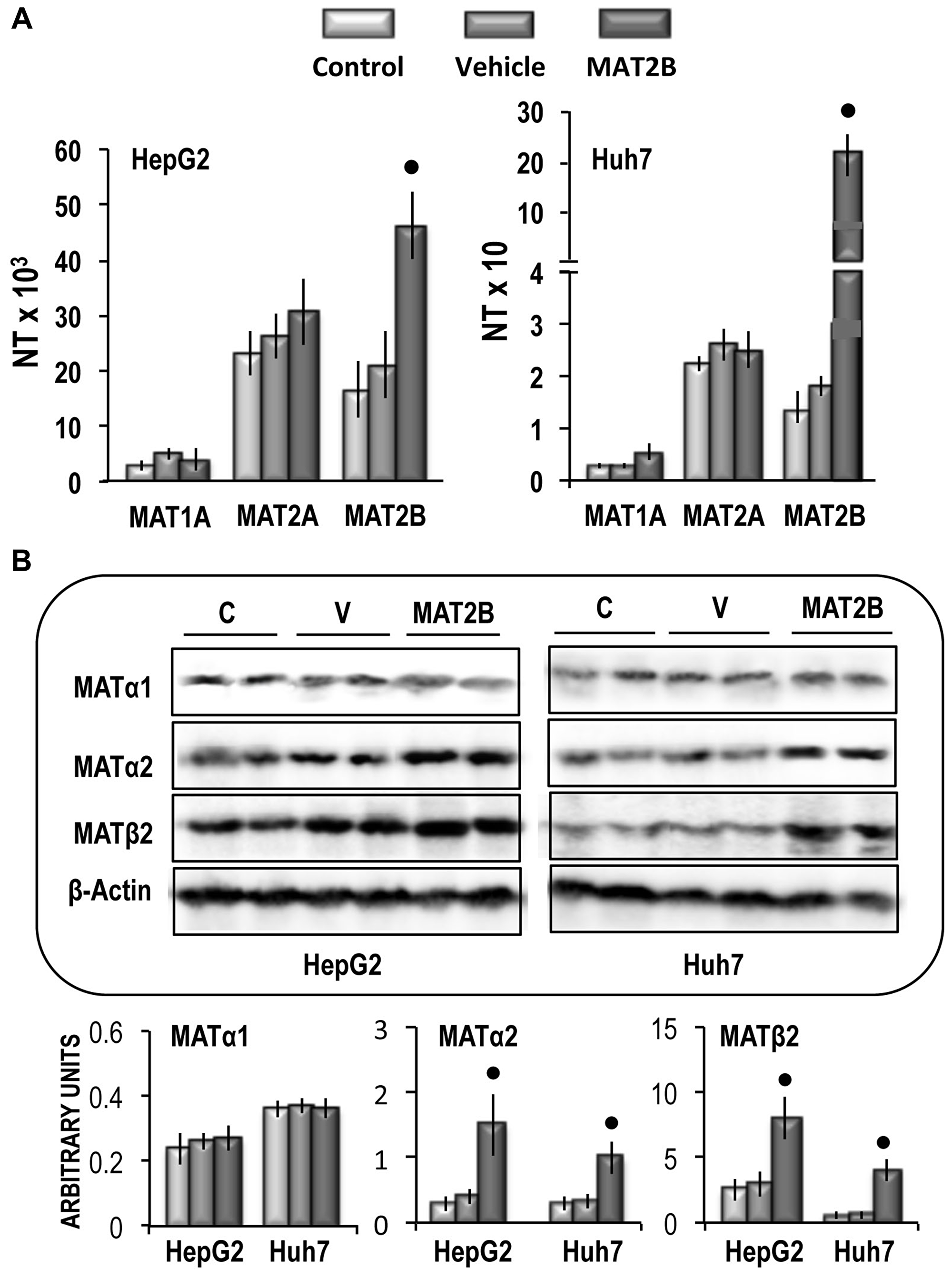 (A) MAT1A, MAT2A and MAT2B gene expression in HepG2 and Huh7 cells. The results are expressed as N-fold differences in target gene expression relative to the RNR-18 expression, named N Target (NT). NT = 2–ΔCT, ΔCT of each sample was calculated by subtracting the Ct of the target gene from the Ct of the RNR-18 gene. (B) Representative Western Blot of MAT1α, MAT2α, and MAT2β. Chemiluminescence analysis: optical densities were normalized to β-actin levels and expressed in arbitrary units. Data are means ± standard deviation (SD) of 5 experiments. Point, different from V for P < 0.001.