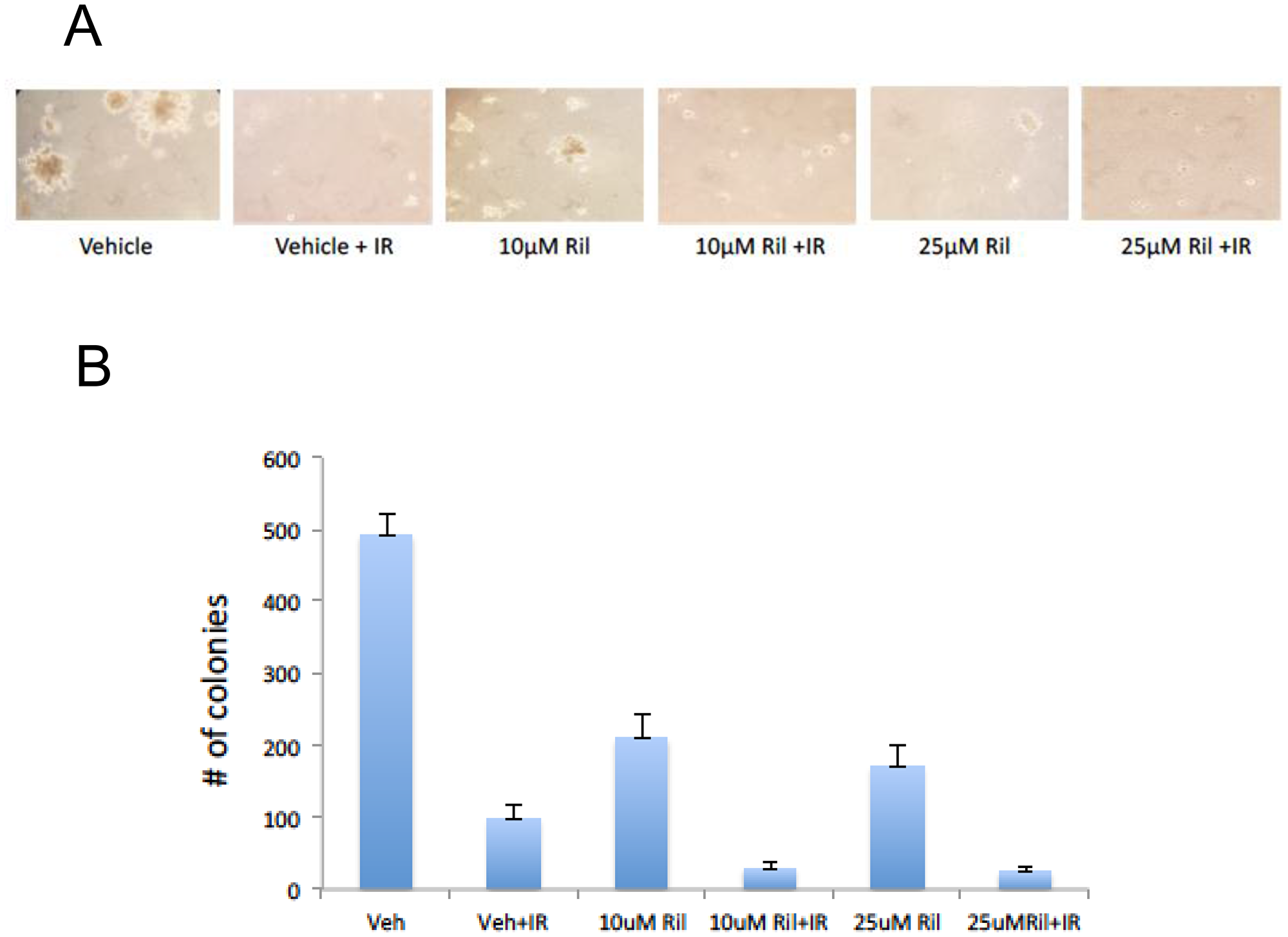RIL + RT reduces anchorage-independent colony growth of glioma cells.