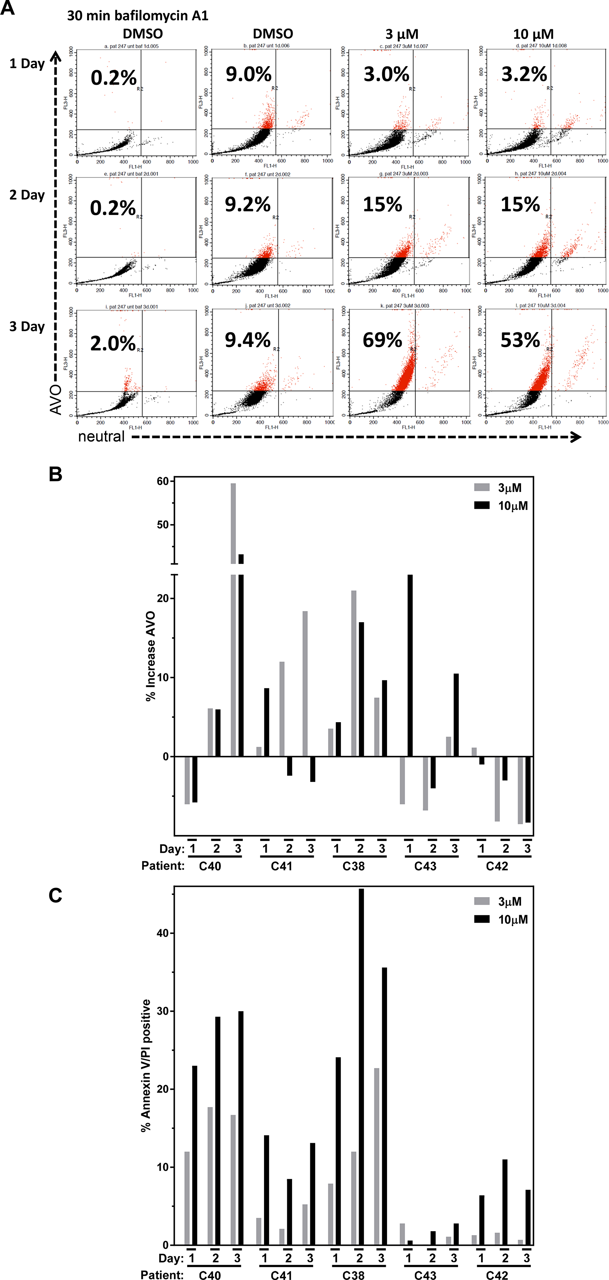Autophagy and cell death after AZD1208 treatment in chronic lymphocytic leukemia (CLL) cells.