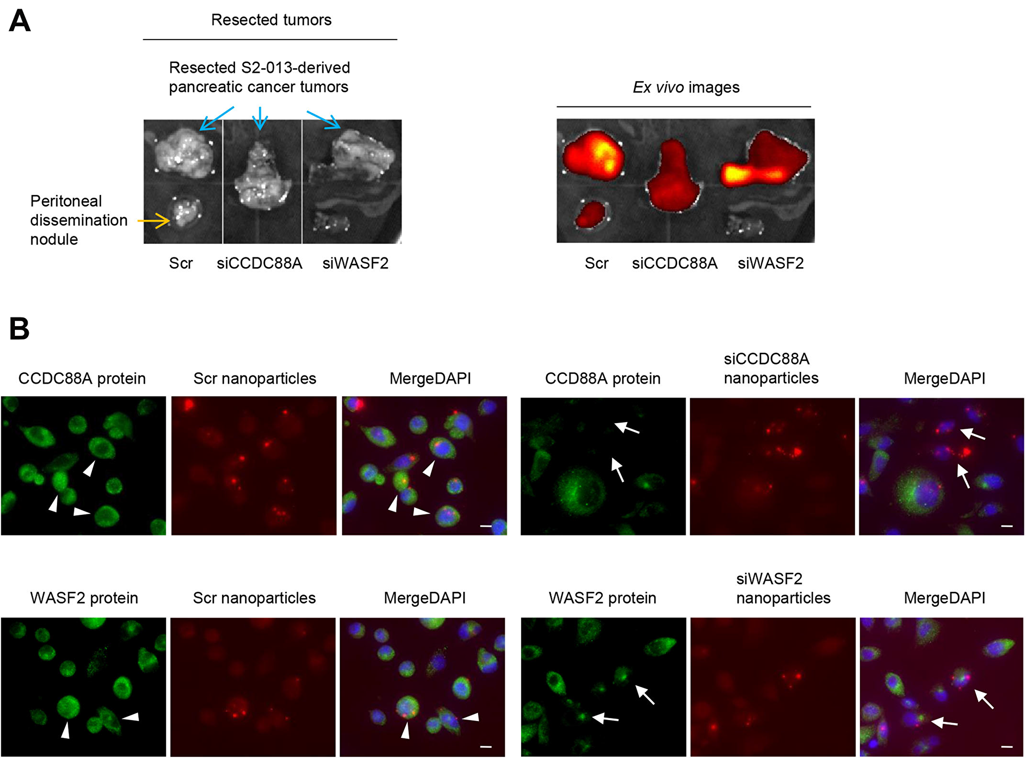 Effect of target siRNA-FA-PEG-COL nanoparticles on silencing of the targets in the orthotopic mouse model of PDAC.