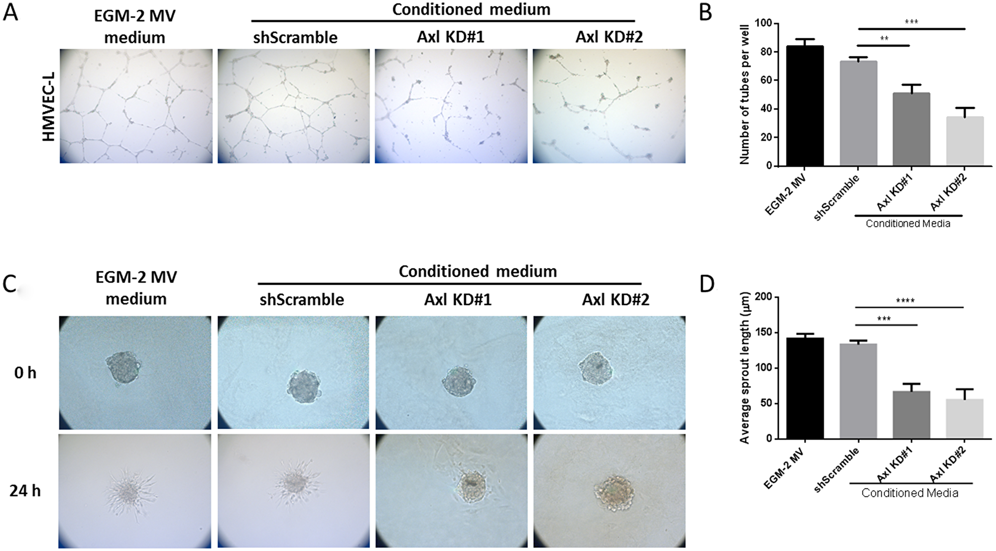Conditioned media from Axl knockdown tumor cells impairs endothelial cell tube formation and sprouting.