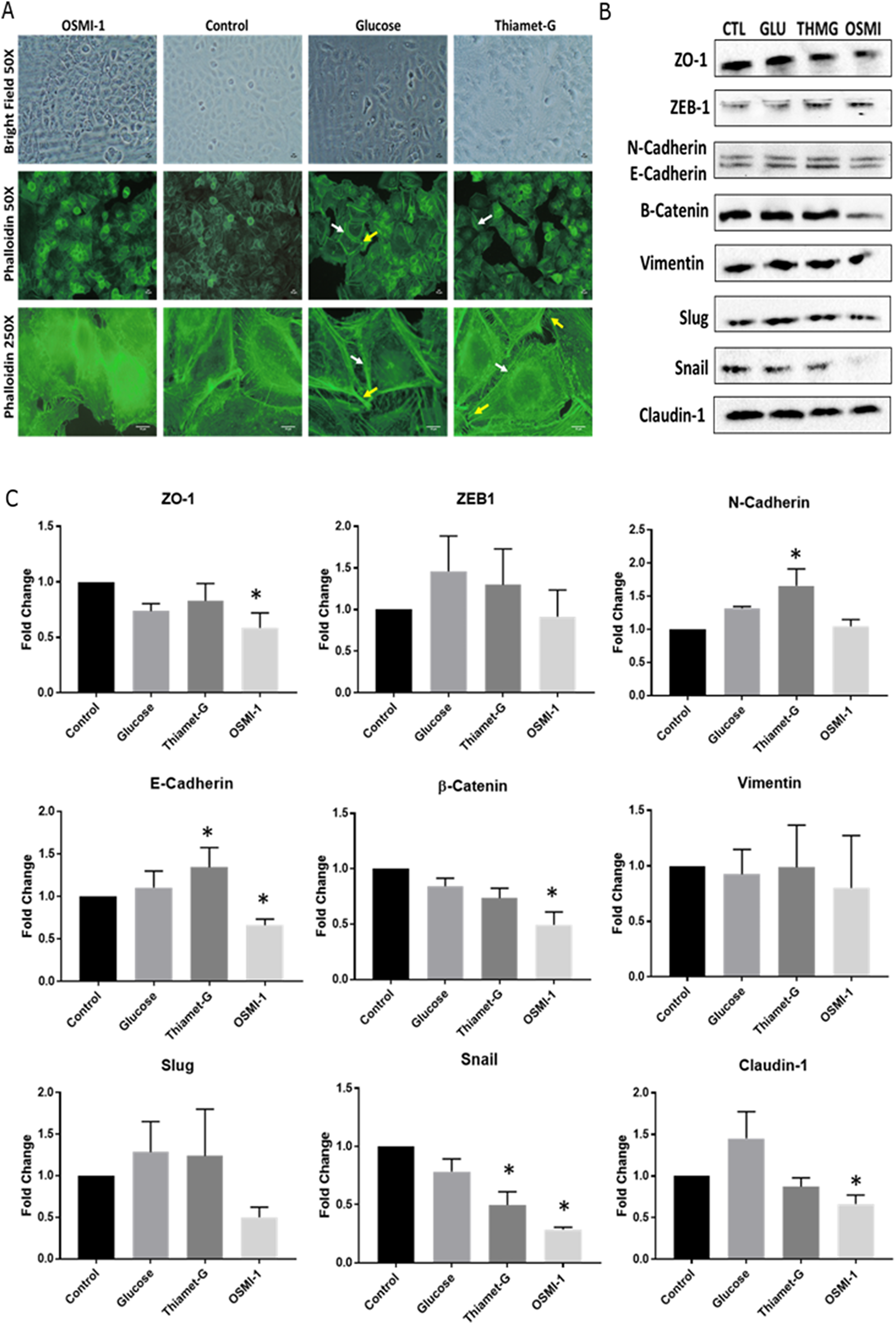 Disruption to O-GlcNAc signaling alters cell morphology and EMT protein expression.