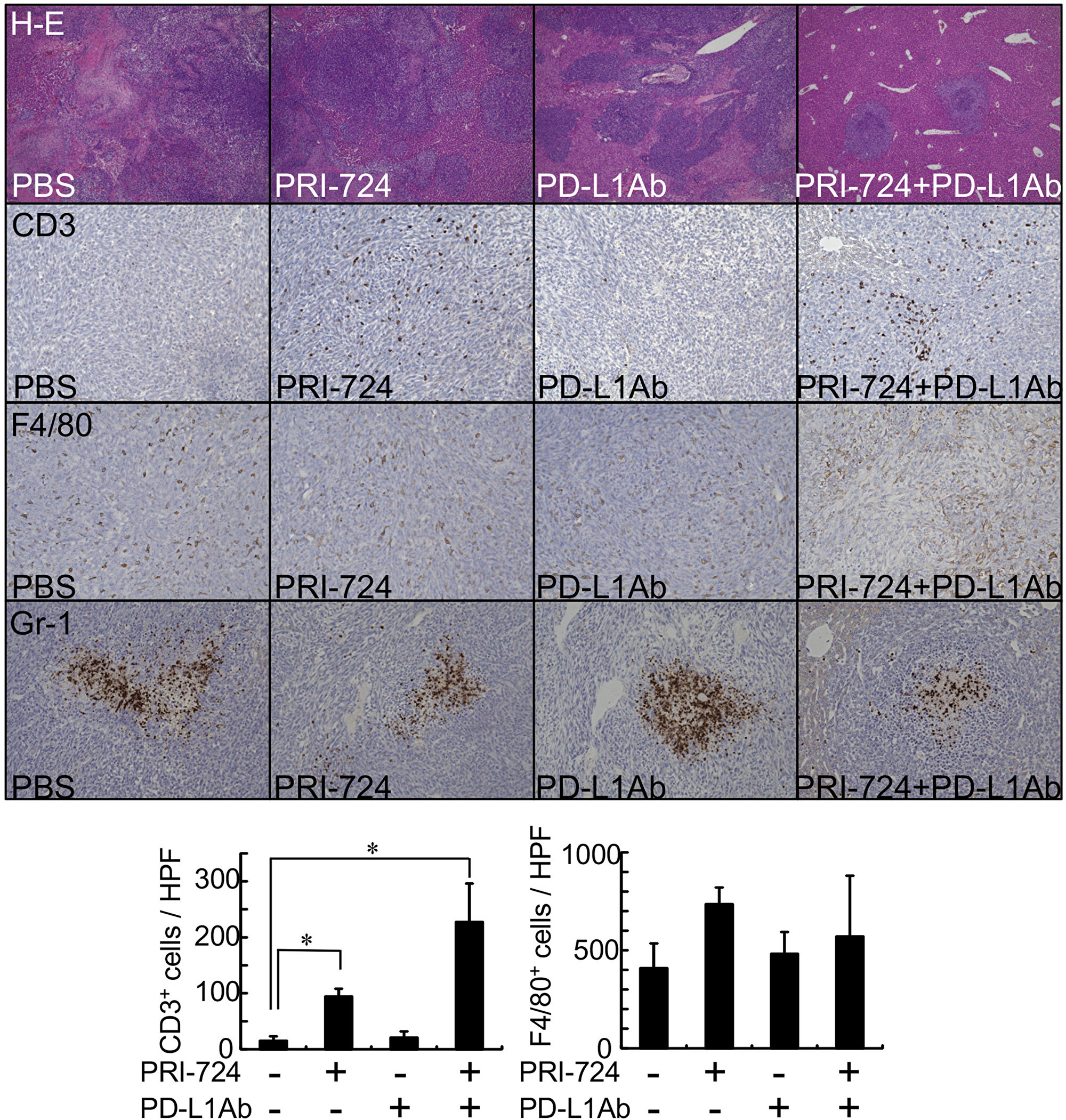 CBP/β-catenin inhibition increased lymphocyte infiltration to metastatic tumors in the liver.
