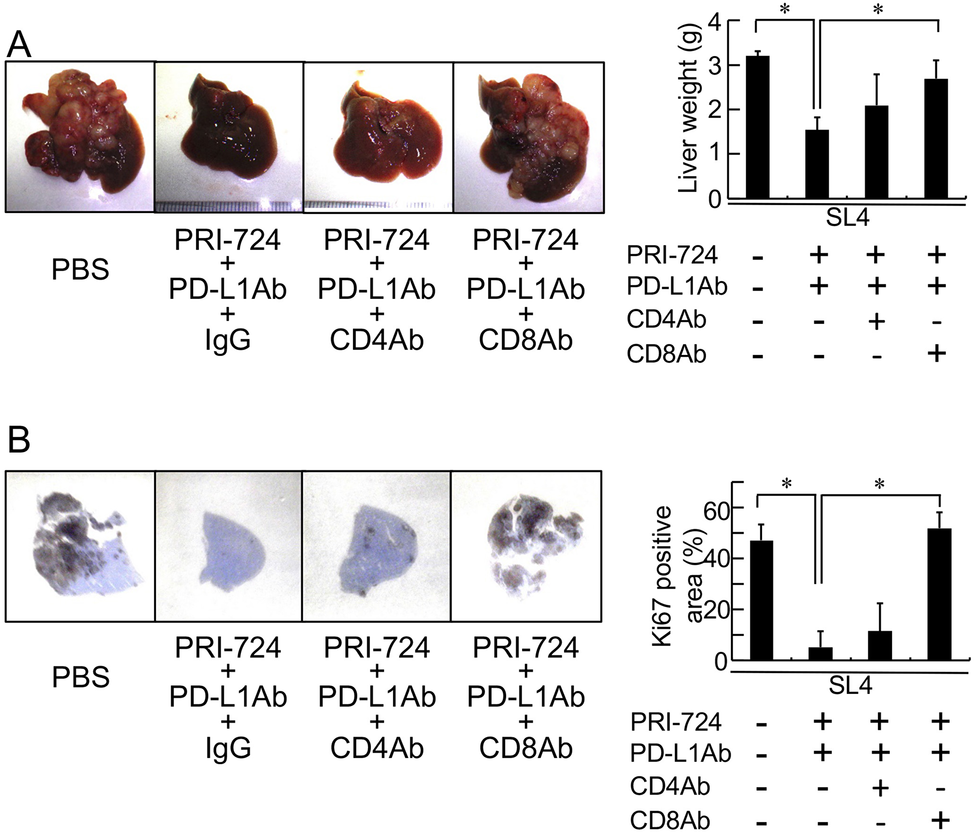 Anti-CD8 antibody (Ab) mitigated the inhibitory effects of an anti-PD-L1 antibody combined with a CBP/β-catenin inhibitor on tumor growth in the liver.