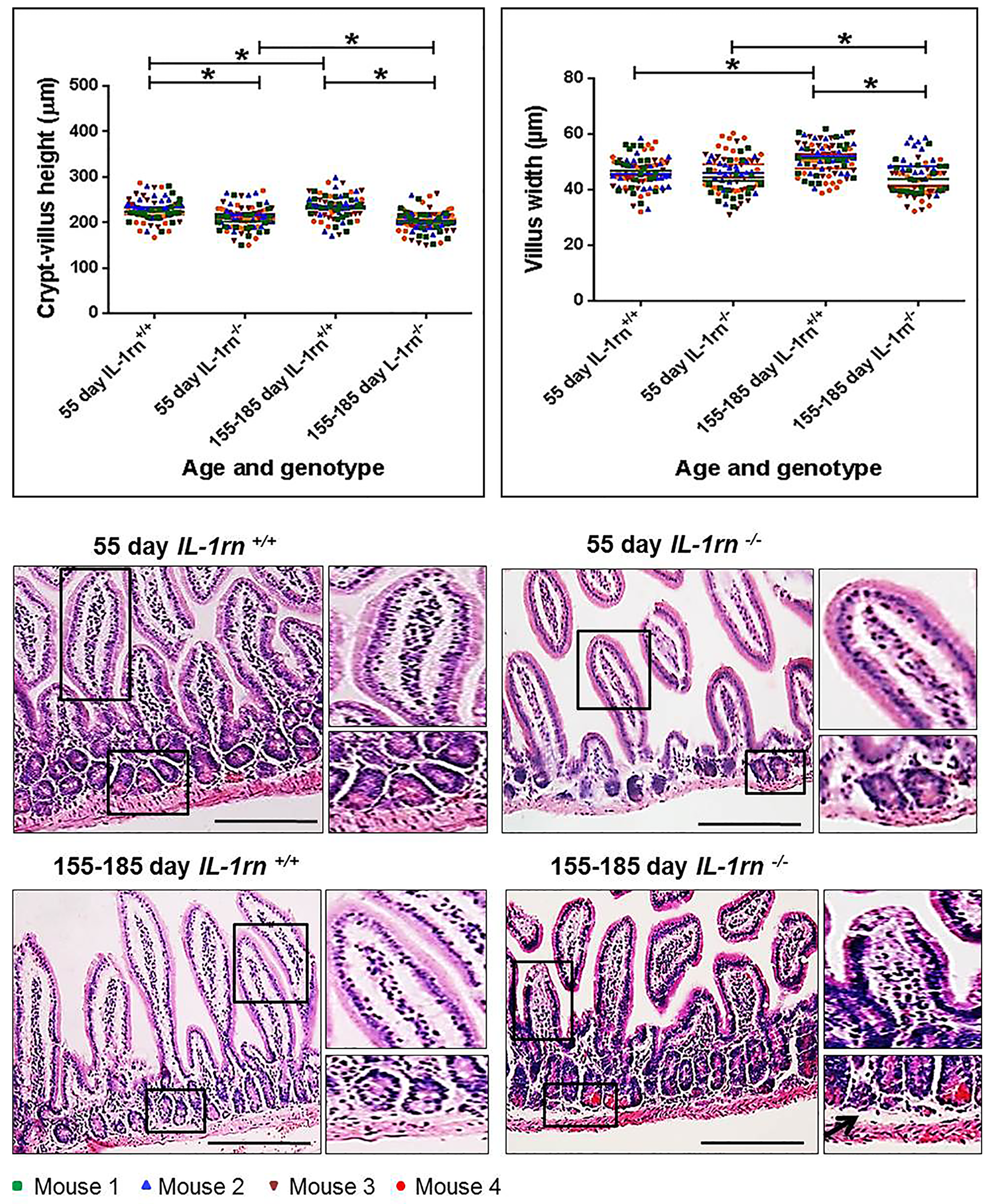 Histological analysis and morphology of the intact well-oriented crypt-villus axis heights and villus widths of Ileum in the 55 day old IL-1rn-/- mice and 155-185 day old IL-1rn-/- mice compared to age-matched wild-type mice.