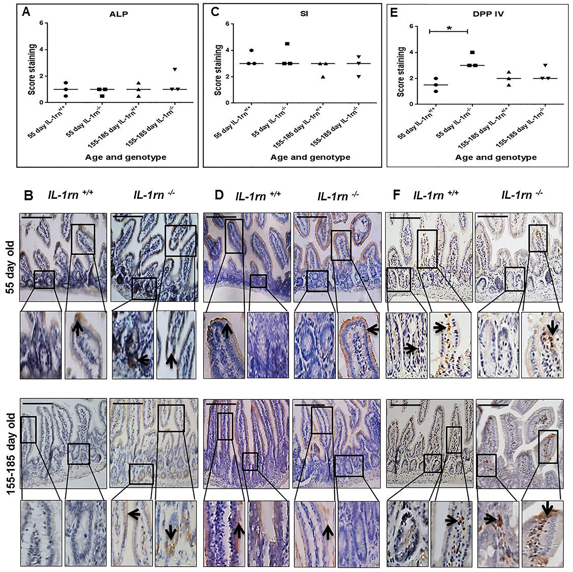 Immunohistochemistry staining of the expression and localization of the digestive enzymes: ALP (A) SI (C) and DPP IV (E) show the immunopositive intensity quantification across the small intestinal architecture. (B, D and F) showing the immunopositive staining in the ileum of the 55 day old and 155-185 day old IL-1rn-/- mice compared with WT mice. Cell nuclei were stained with haematoxylin (blue). Black arrows indicate immunopositivity. *P ≤ 0.05. Scale bar = 100 µm.