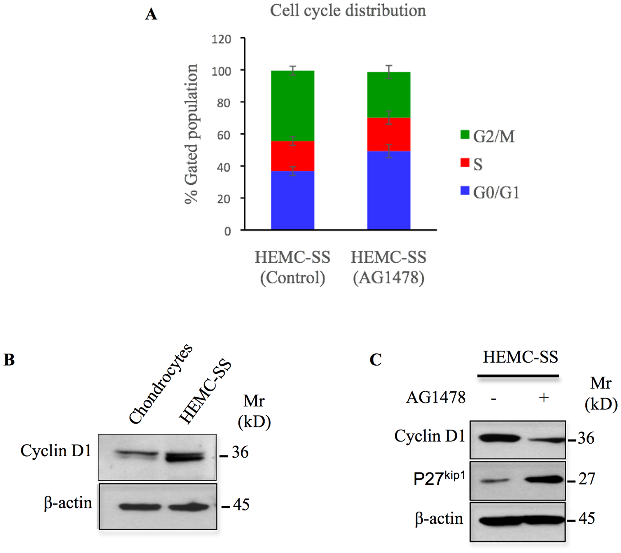 AG1478 produces cell cycle arrest, induces p27 and inhibits cyclin D1 in chondrosarcoma cells.