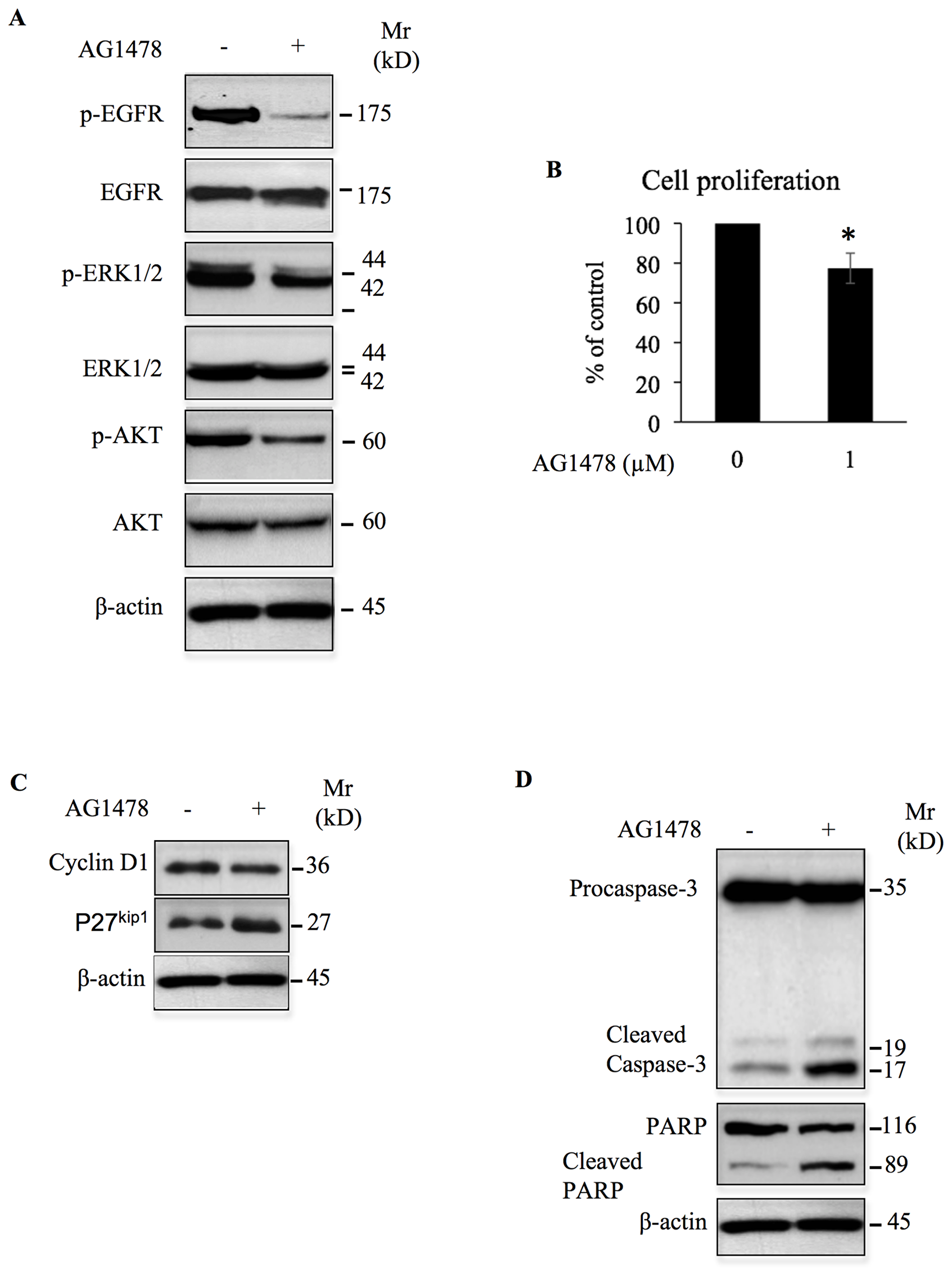AG1478 inhibits oncogenic signals and cell growth, and induces apoptosis in high-grade chondrosarcoma cells.