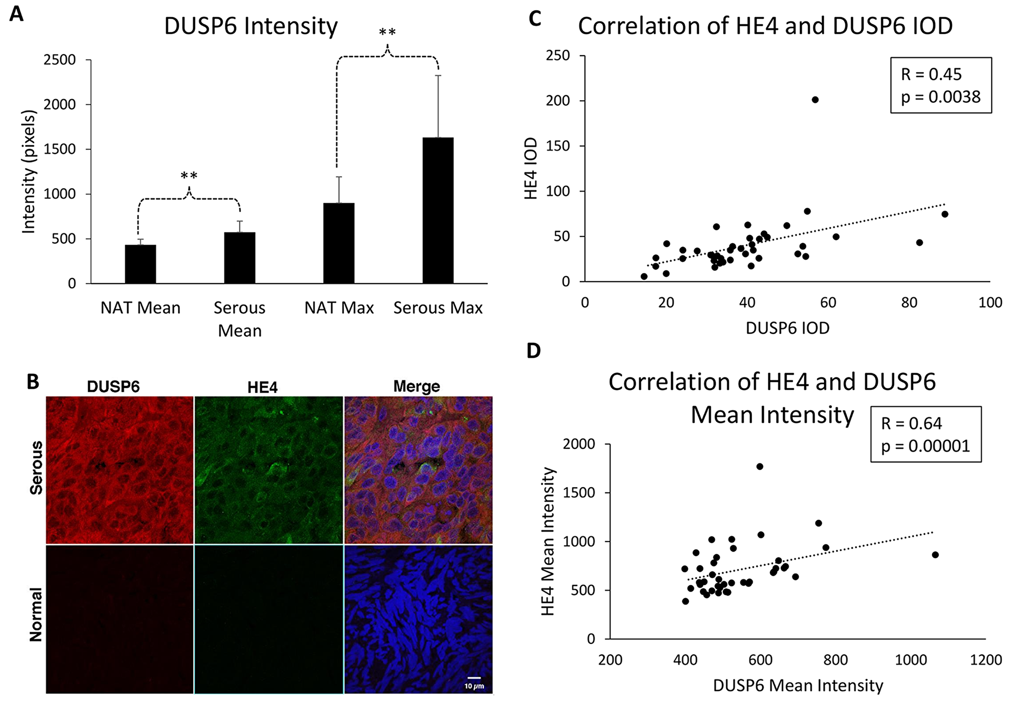 DUSP6 levels are higher in EOC tissue than normal adjacent tissue, and correlate with HE4 tissue levels