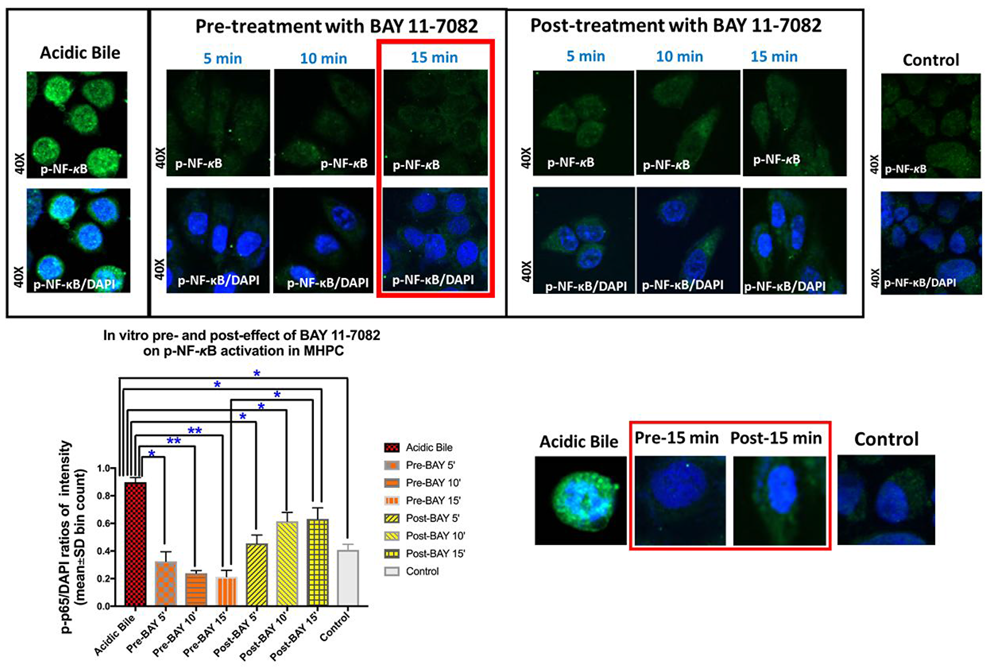 Pre- or post-application of BAY 11-7082 inhibits the acidic bile-induced nuclear translocation of phospho-NF-κB in MHPC.