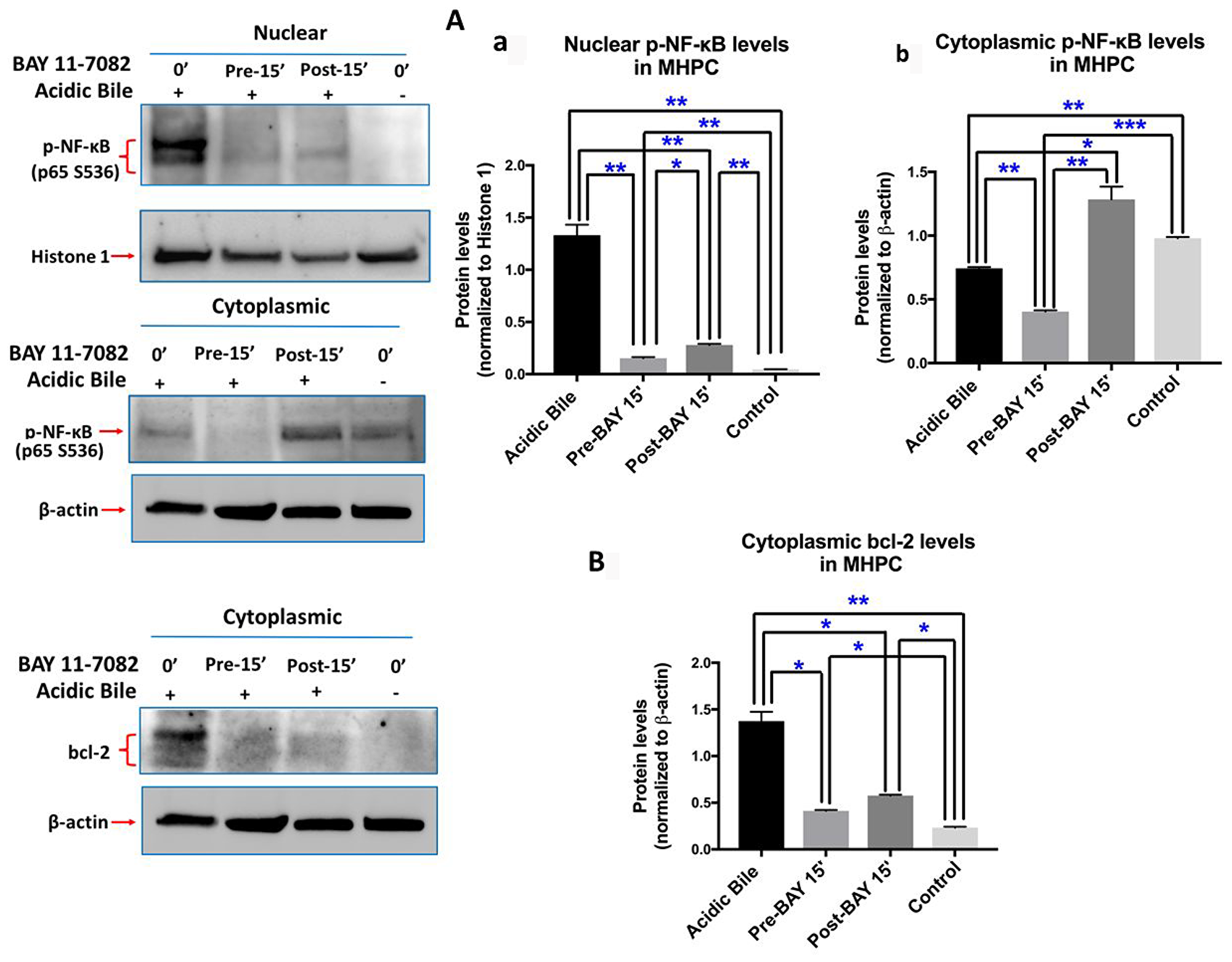 Pre- or post-application of ΒΑΥ 11-7082 inhibits acidic bile-induced NF-κB activation and bcl-2 overexpression in MHPC.