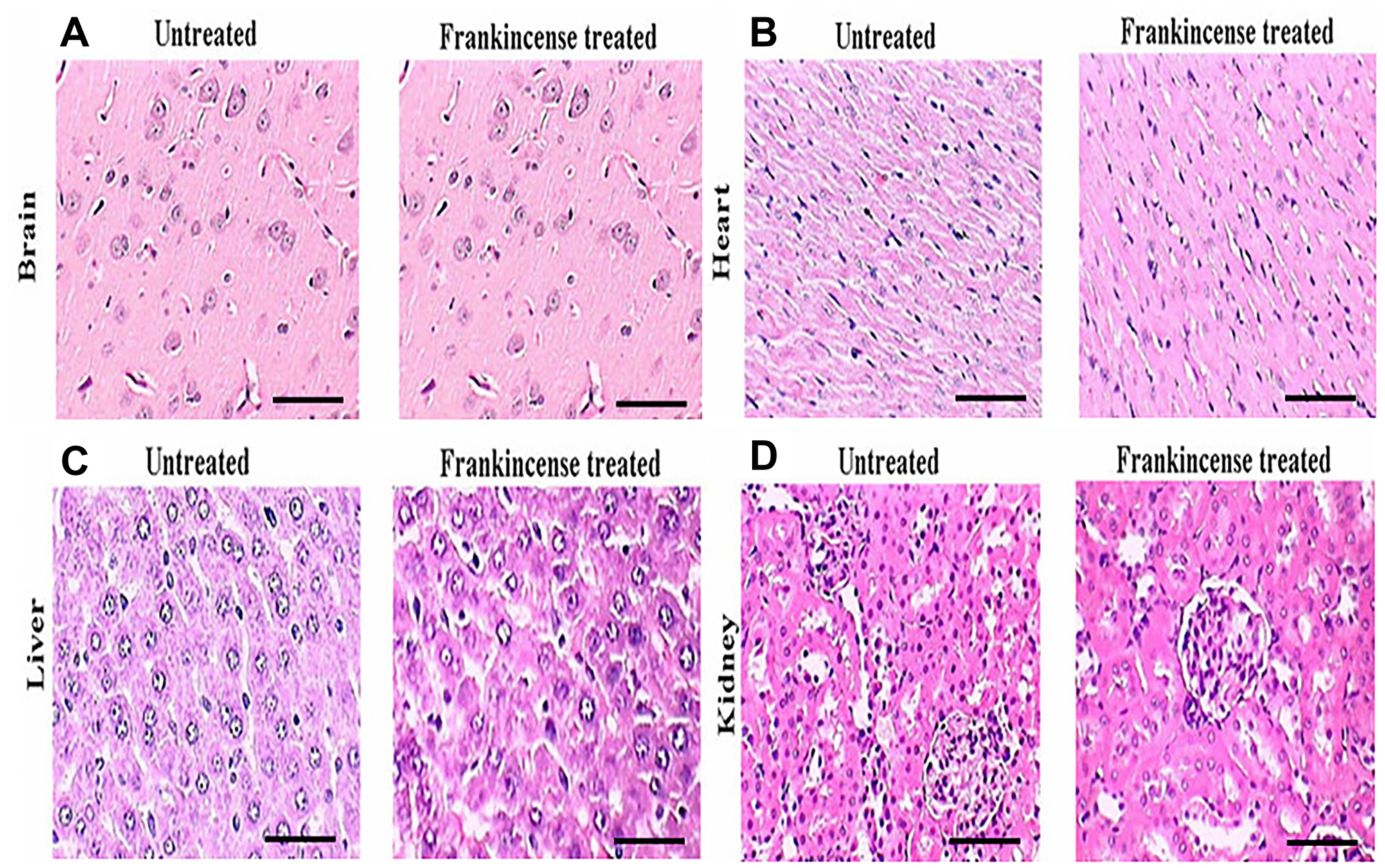 In vivo of toxicity of FEO on major organs: