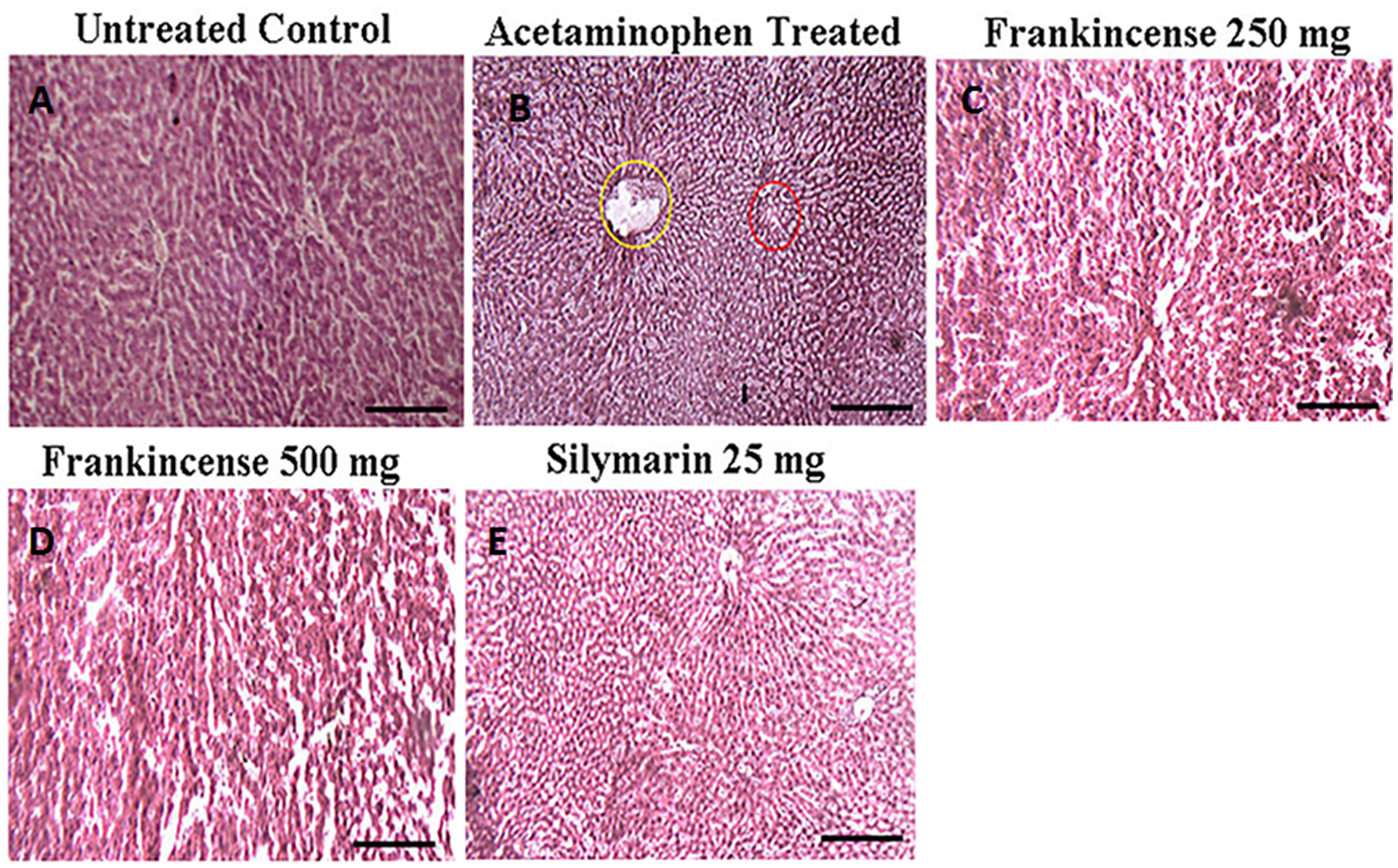 Efficacy of FEO on acetaminophen induced hepatic injury: