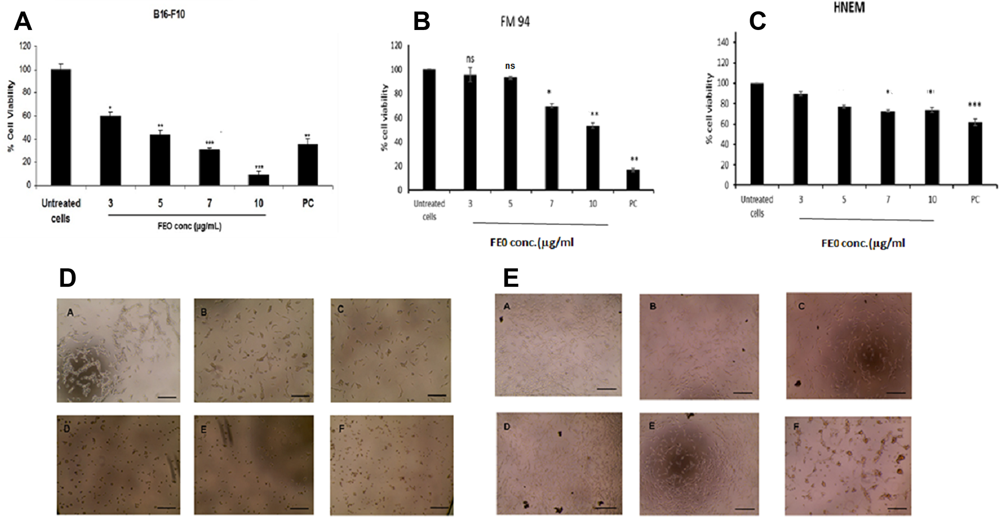 Cytotoxicity of FEO on B16-F10, FM94 and HNEM cells.