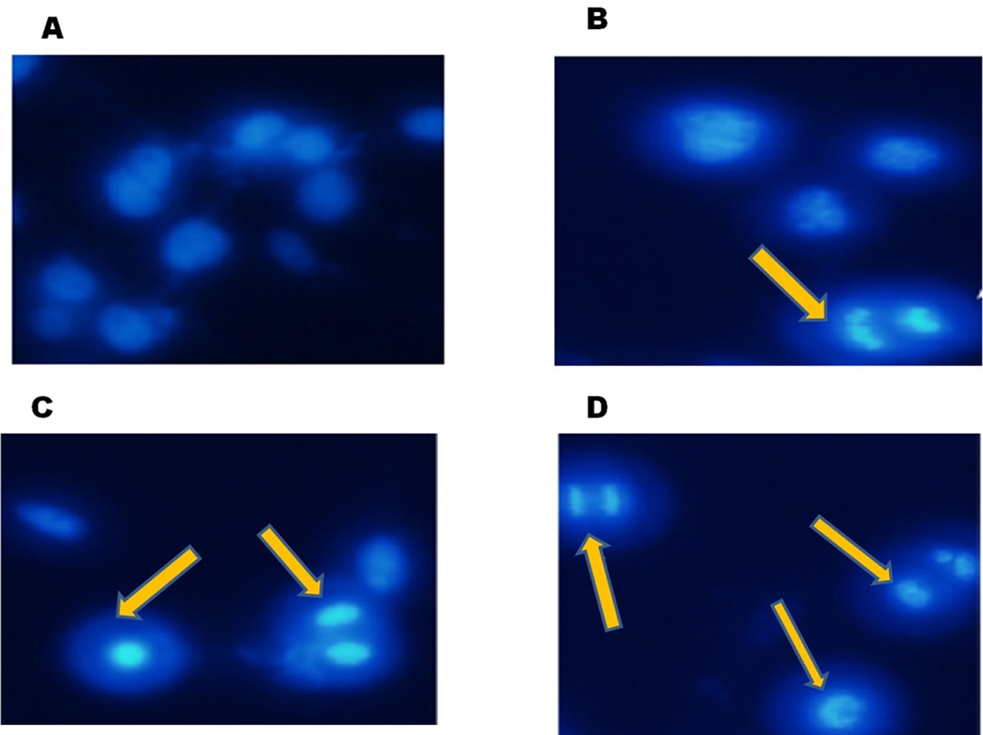 FEO induced nuclear fragmentation in B16-F10 cells: B16-F10 cells were treated with different concentrations of FEO for 24 hours and stained with hoechest stain 33258.