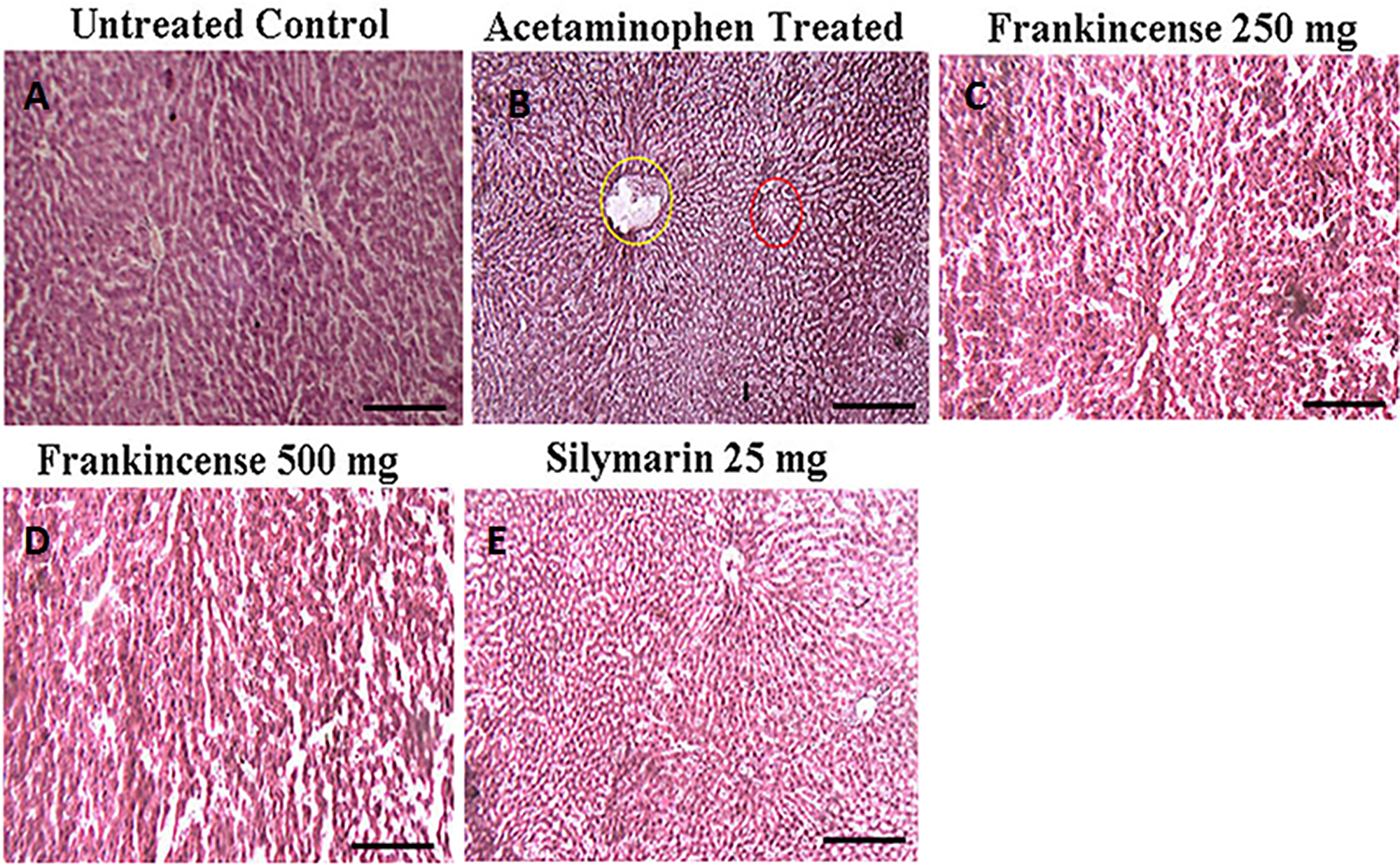 Efficacy of FEO on acetaminophen induced hepatic injury: Mice were divided into five groups (n = 6).