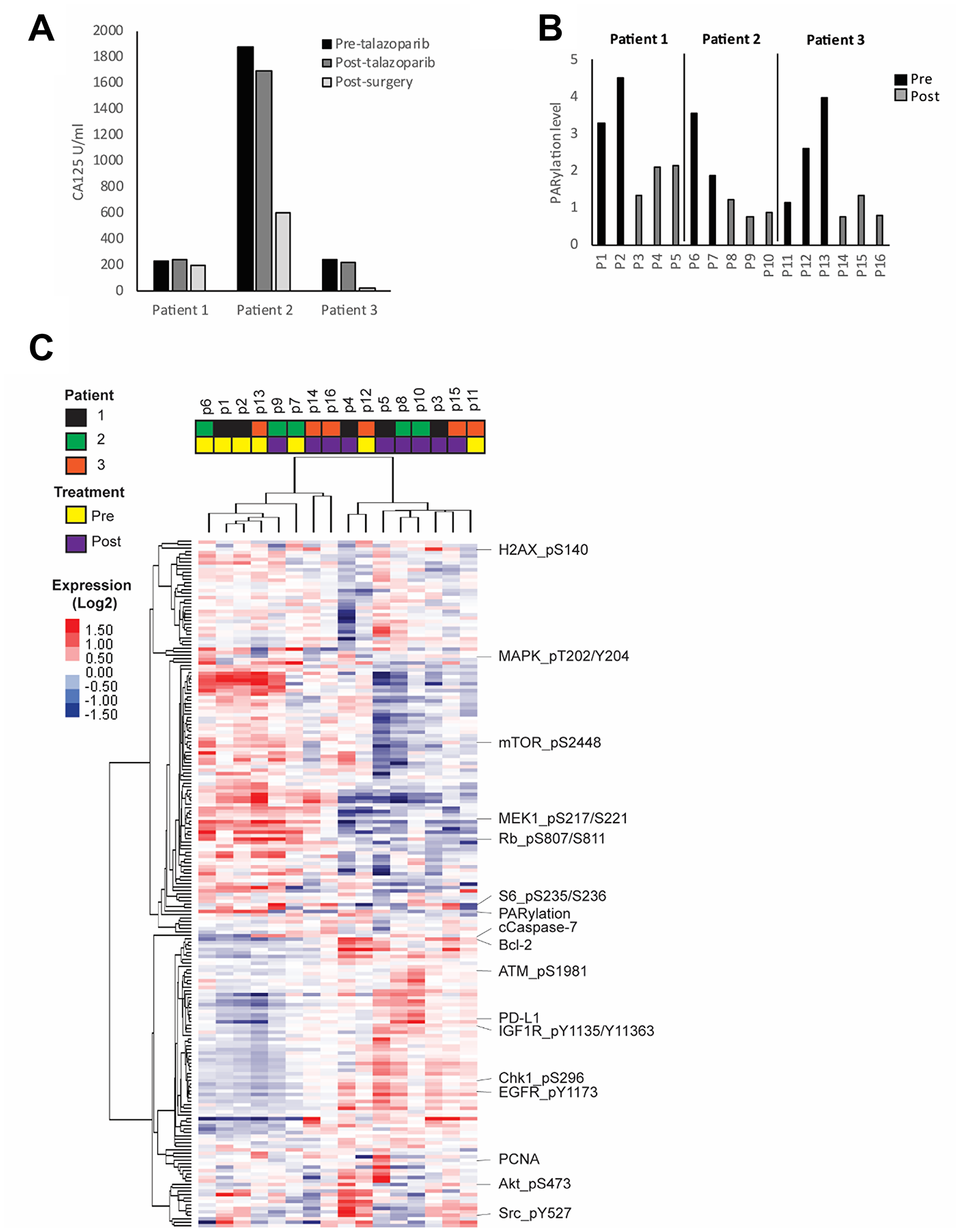 HGSOC response to PARP inhibitor.