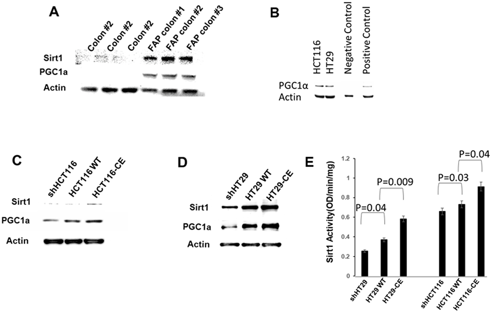 ETHE1 regulates the Sirt1/PGC1α axis.