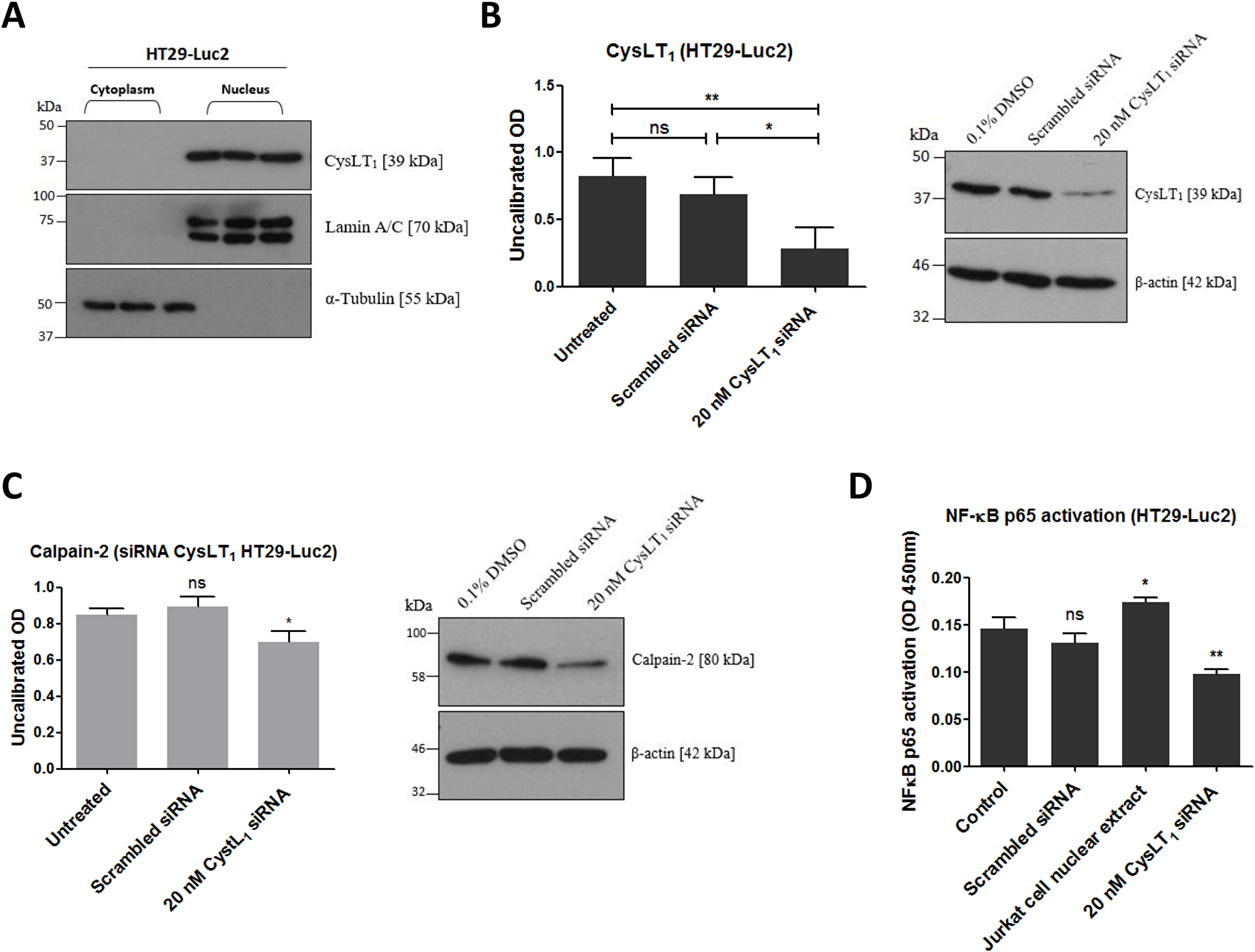Effects of CysLT1 gene silencing in HT29-Luc2 cells.