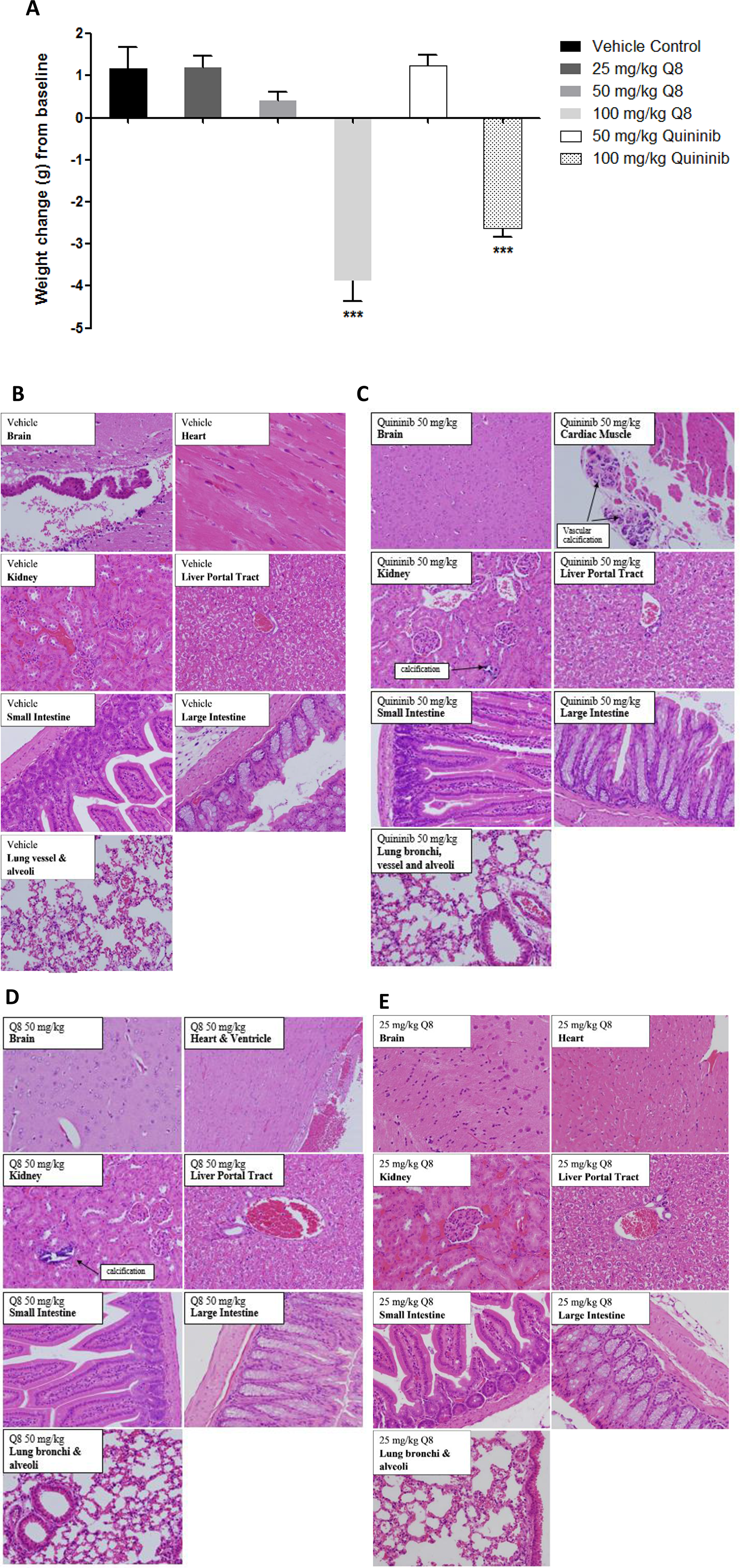 Weight changes of Balb/C wild type mice following i/p injection of Q1 and Q8 and histopathological analysis of organs obtained after treatment of mice with vehicle (10% DMSO) or 25 mg/kg Q8 showing absence of microscopic abnormalities.
