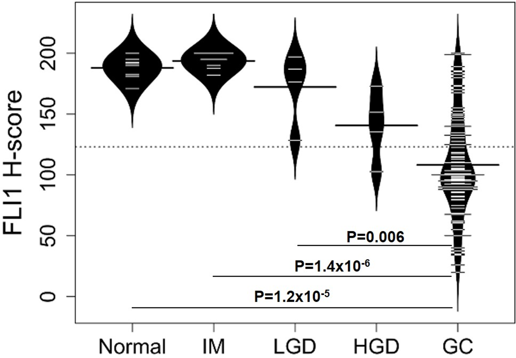 Distributions of FLI1 H-scores for different types of gastric tissue