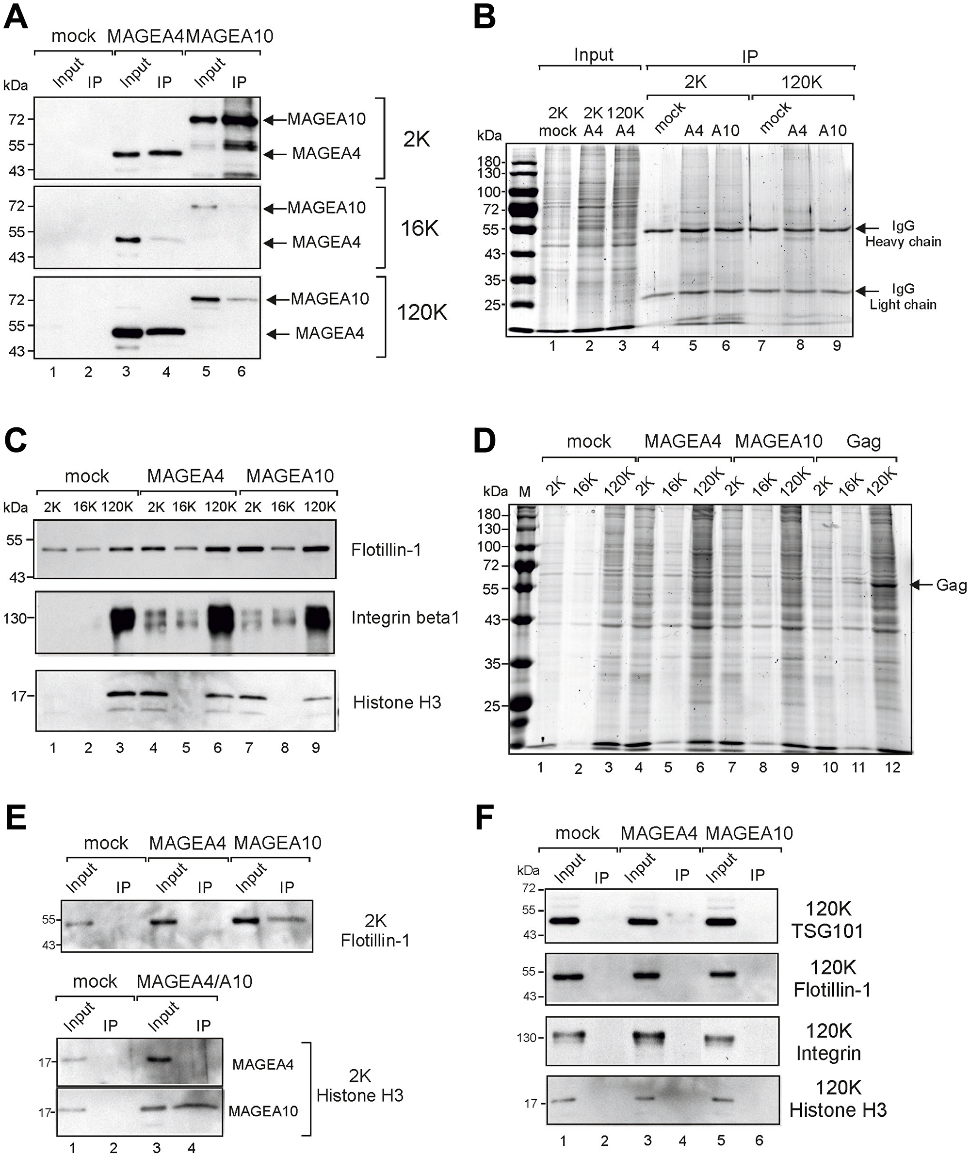 Immunoprecipitation of MAGEA-EVs.