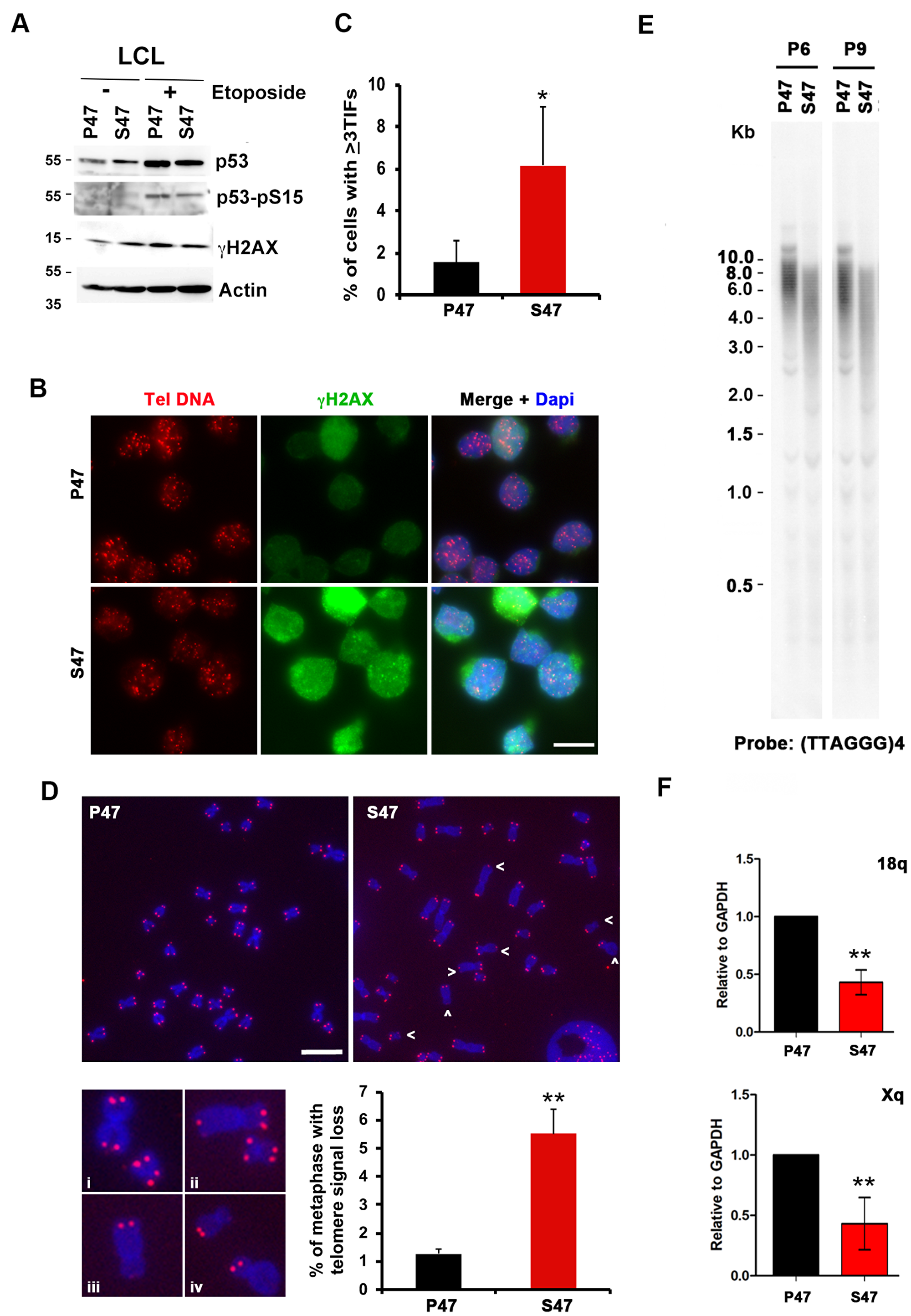 Telomere DNA damage foci and decreased TERRA in human LCLs carrying homozygous p53 S47.