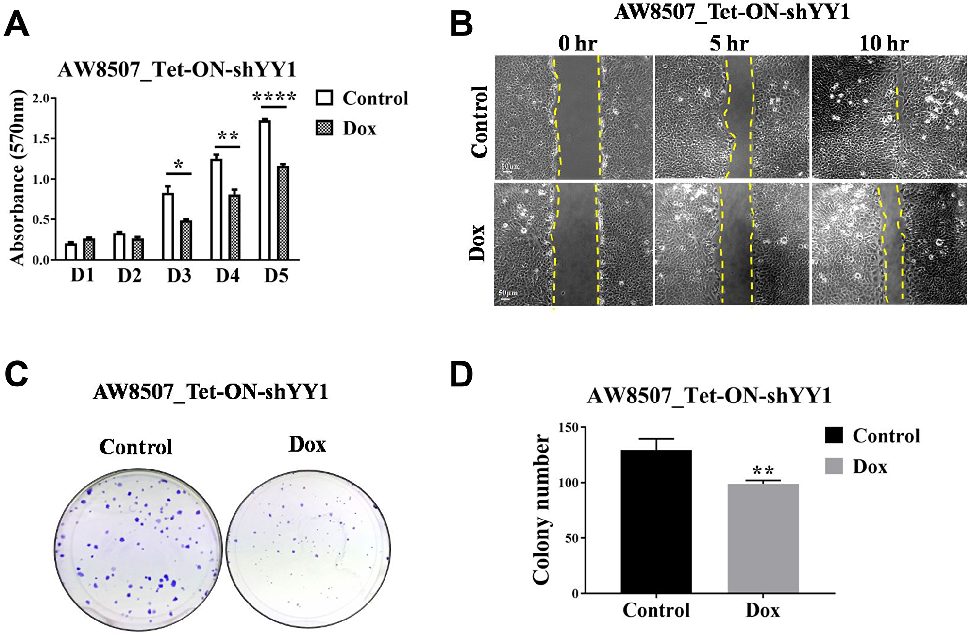 Elucidation of oncogenic role of YY1 in oral cancer cell line.