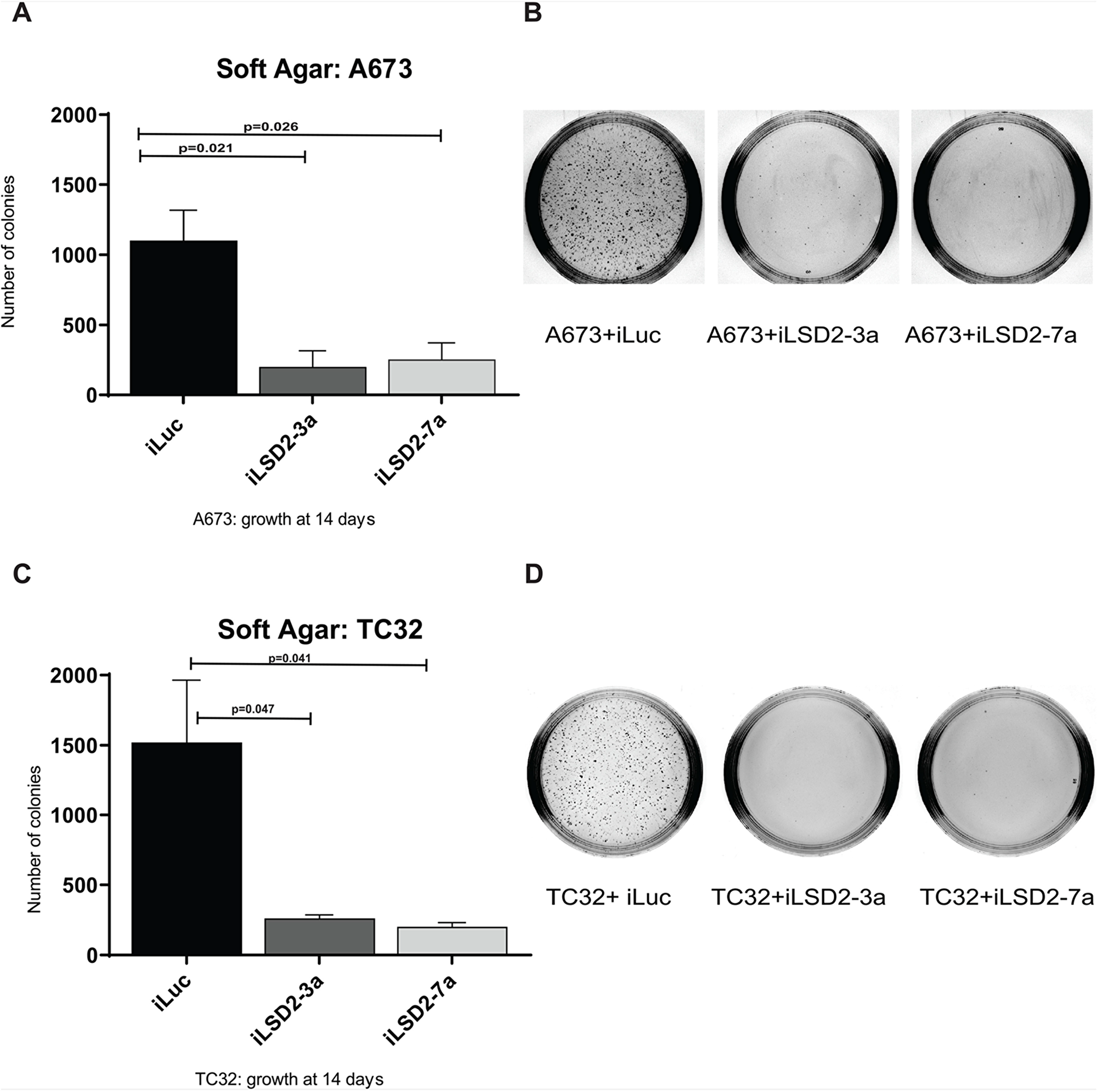 LSD2 knockdown significantly impairs the anchorage-independent growth capacity of Ewing sarcoma cells.