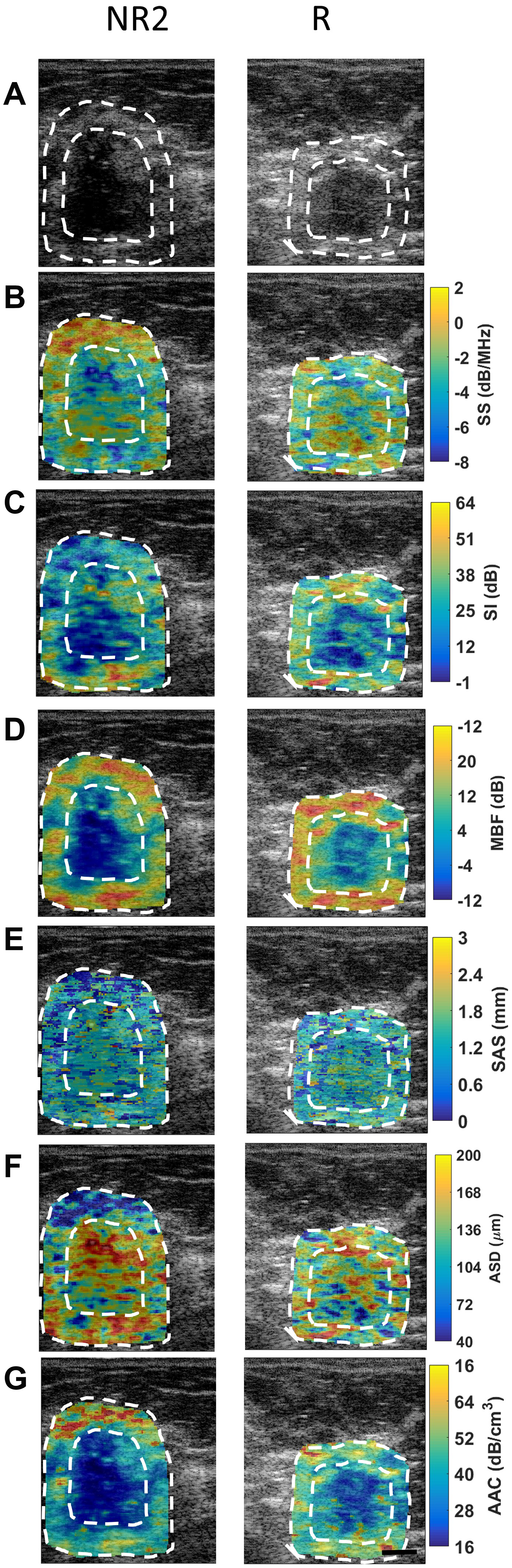 QUS images from a representative non-responder (NR2) patient and a representative responder patient with outlines of core and margin ROIs.