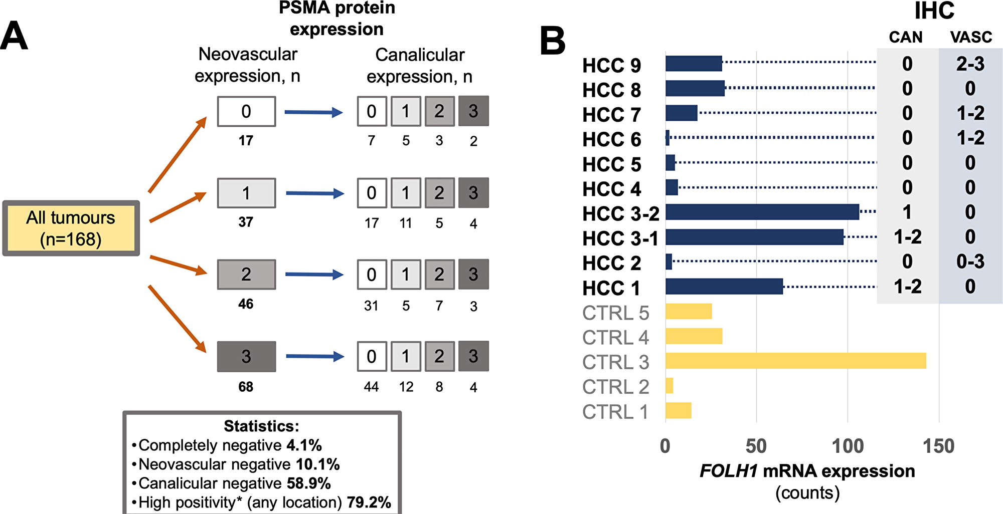 (A) PSMA protein expression in 168 tumors from 153 patients with hepatocellular carcinoma HCC (immunohistochemistry cohort), illustrating stratification according to two different staining patterns of tumor tissue (neovascular and canalicular). In general, HCCs demonstrate very high levels of PSMA positivity. (B) Comparison of PSMA protein expression and FOLH1 mRNA expression (absolute expression, measured in counts) in 10 representative HCC from 9 patients (immunohistochemistry cohort) and 5 non-matched benign liver samples (CTRL). Whole block sections were used for analysis. For immunohistochemical protein expression (right side) numbers represent staining intensity (semiquantitative: “0” – no expression, “1” – weak, “2” – moderate, “3” – strong expression), ranges outline intratumoral heterogeneity of corresponding staining pattern. Abbreviations: IHC – immunohistochemistry, CAN – canalicular staining pattern, VASC – neovascular staining pattern.