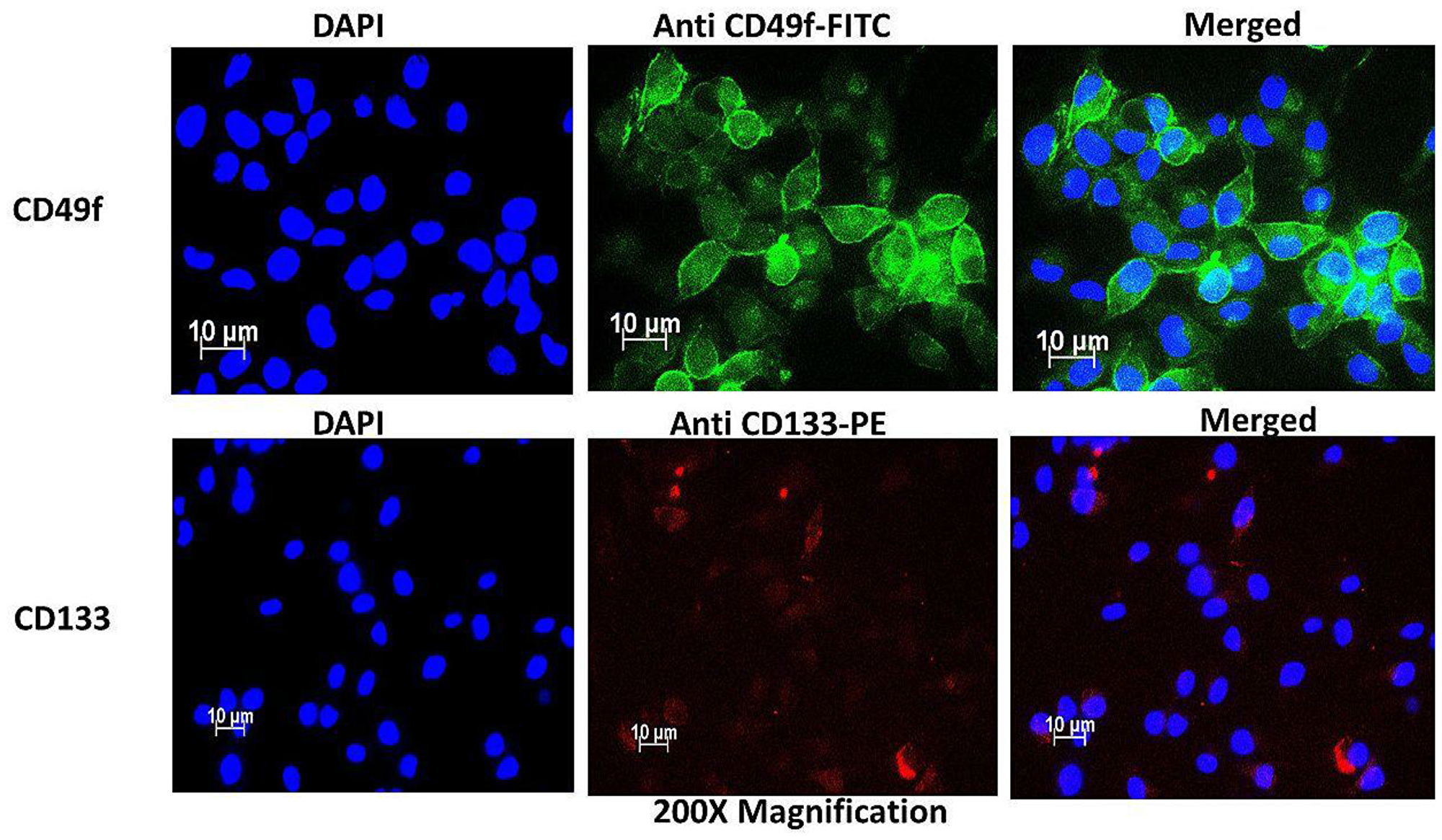 Immunofluorescence characterization of cervical side population cells indicating the presence of cervical CSC surface markers CD49f stained with FITC (green) and CD133 stained with PE (Red).