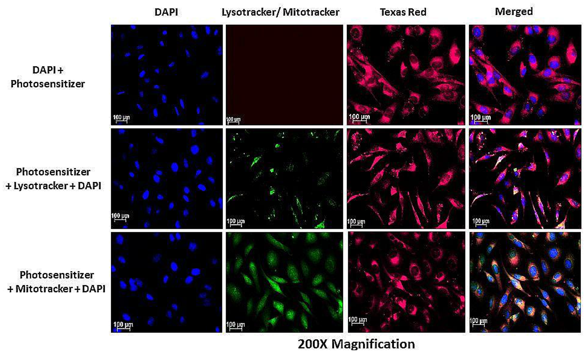 Subcellular localization of AlPcSmix in HeLa cells showing the localization of the PS (Texas Red) in the cytoplasm (red), lysosomes and mitochondria (seen as blending of green and red).