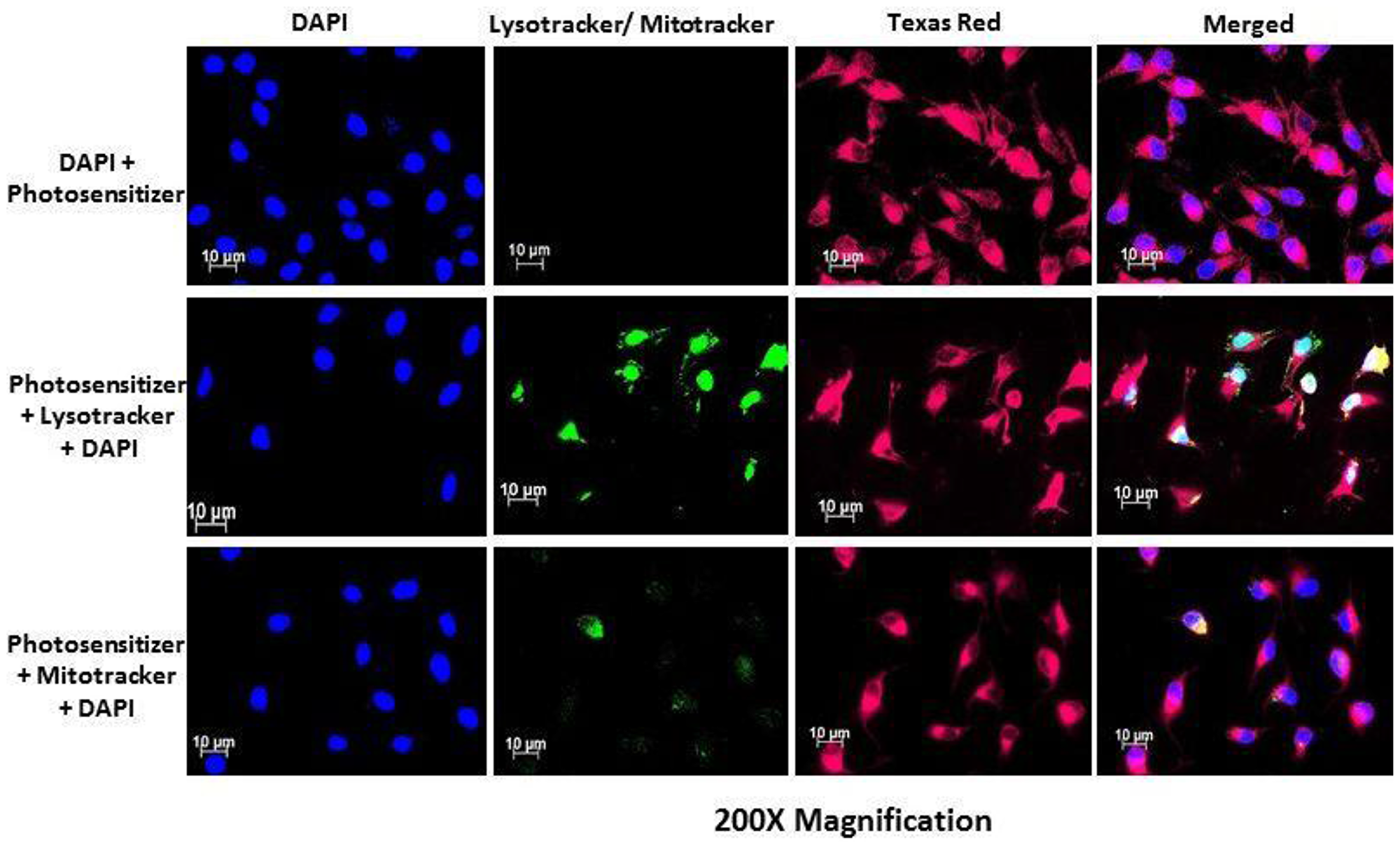 PS subcellular localization in HeLa side population indicating accumulation of the PS (Texas Red) in the cytoplasm of the HeLa side population.